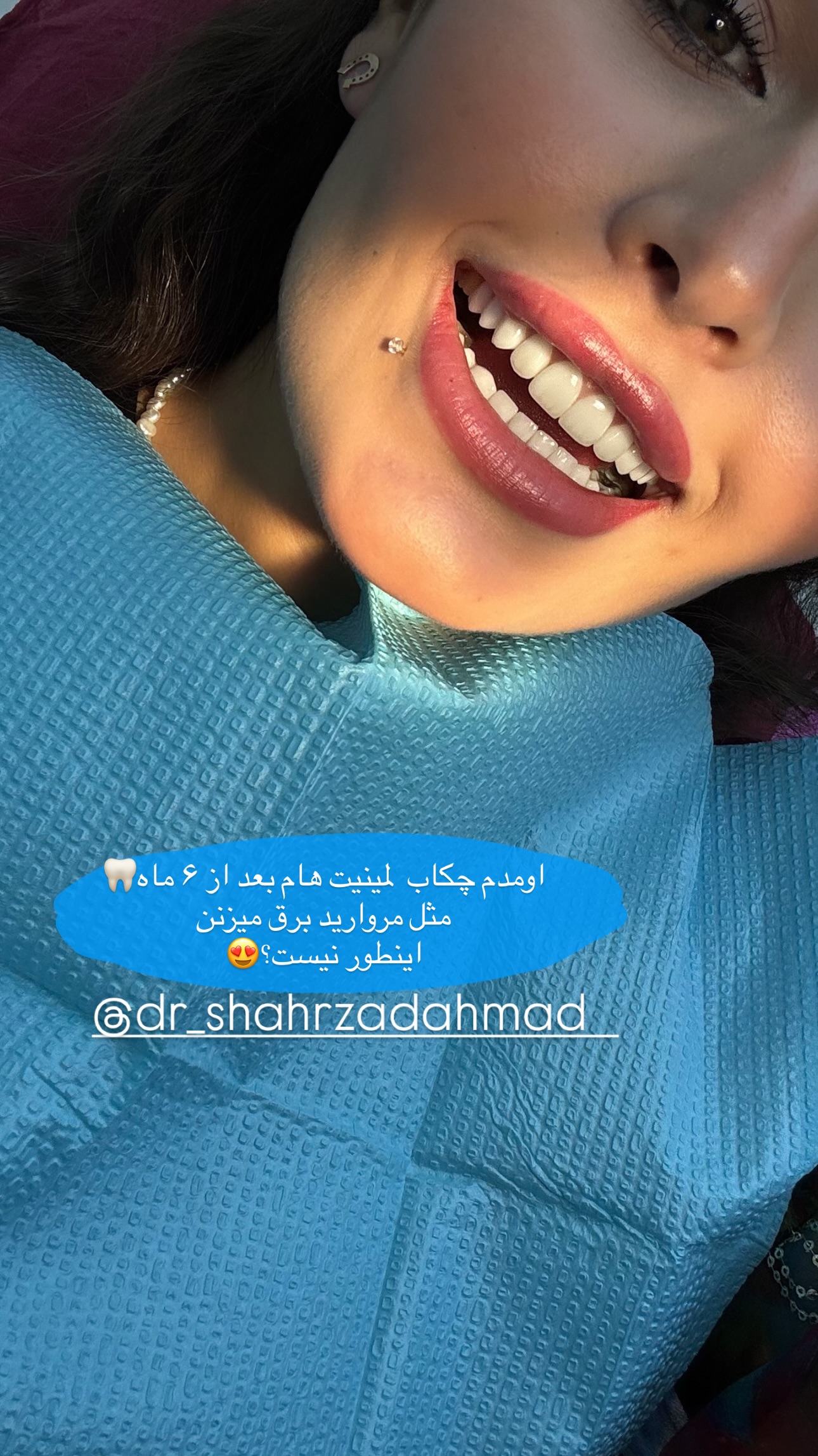  جدید ترین استوری اینستاگرام ستاره داودی
