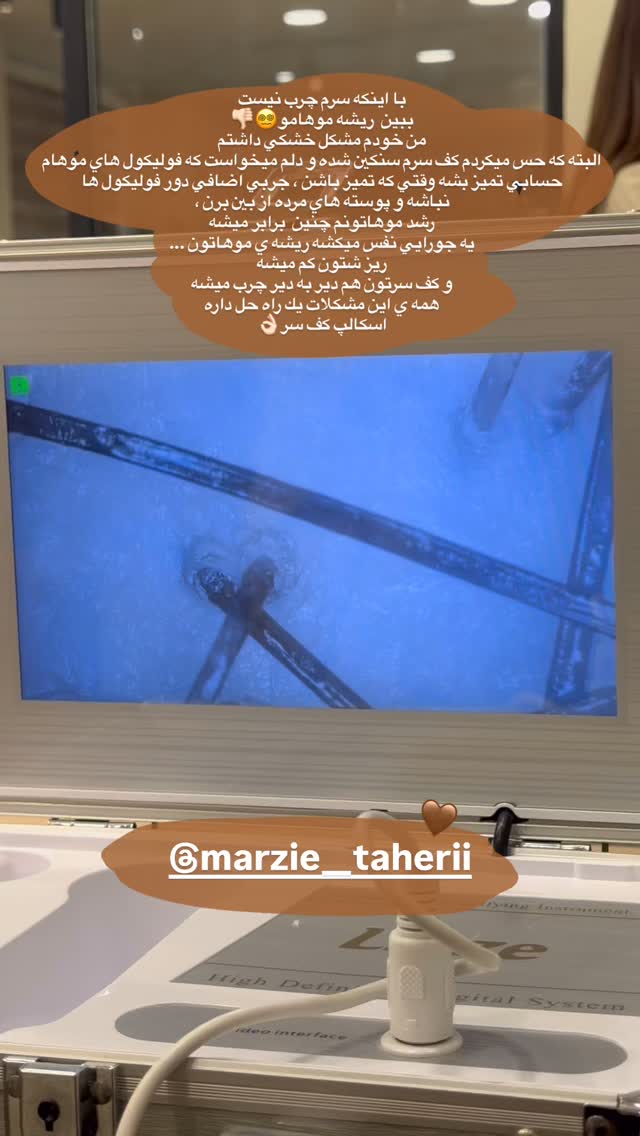 جدید ترین استوری اینستاگرام ستاره داودی