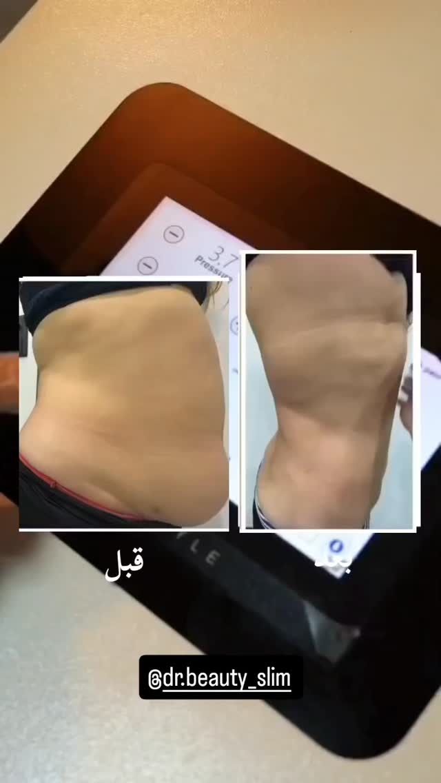  جدید ترین استوری اینستاگرام سودا