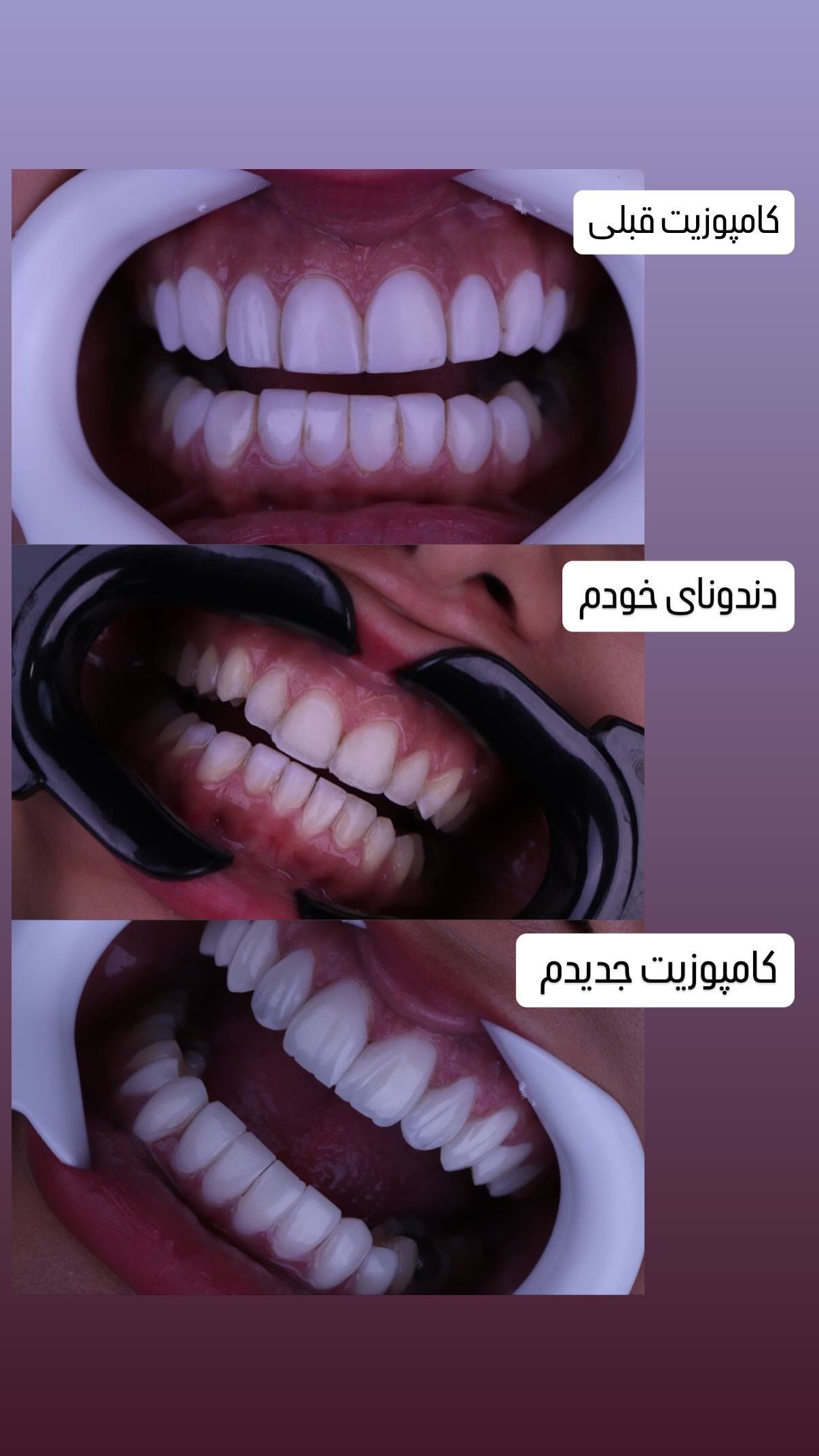  جدید ترین استوری اینستاگرام شهرزاد سرخی