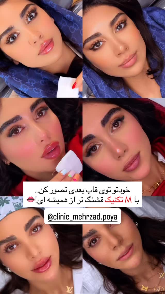  جدید ترین استوری اینستاگرام شهرزاد سرخی