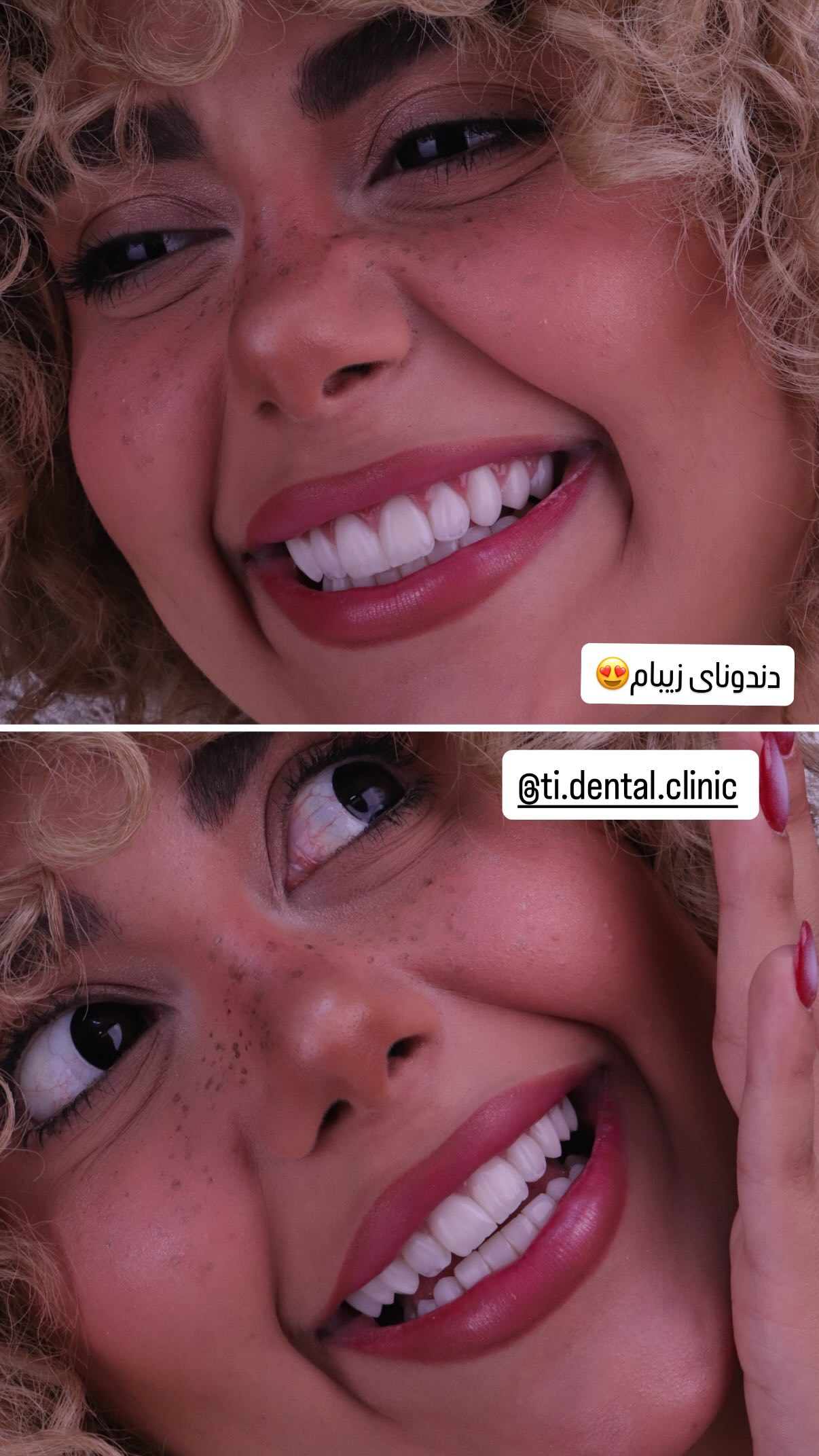  جدید ترین استوری اینستاگرام شهرزاد سرخی
