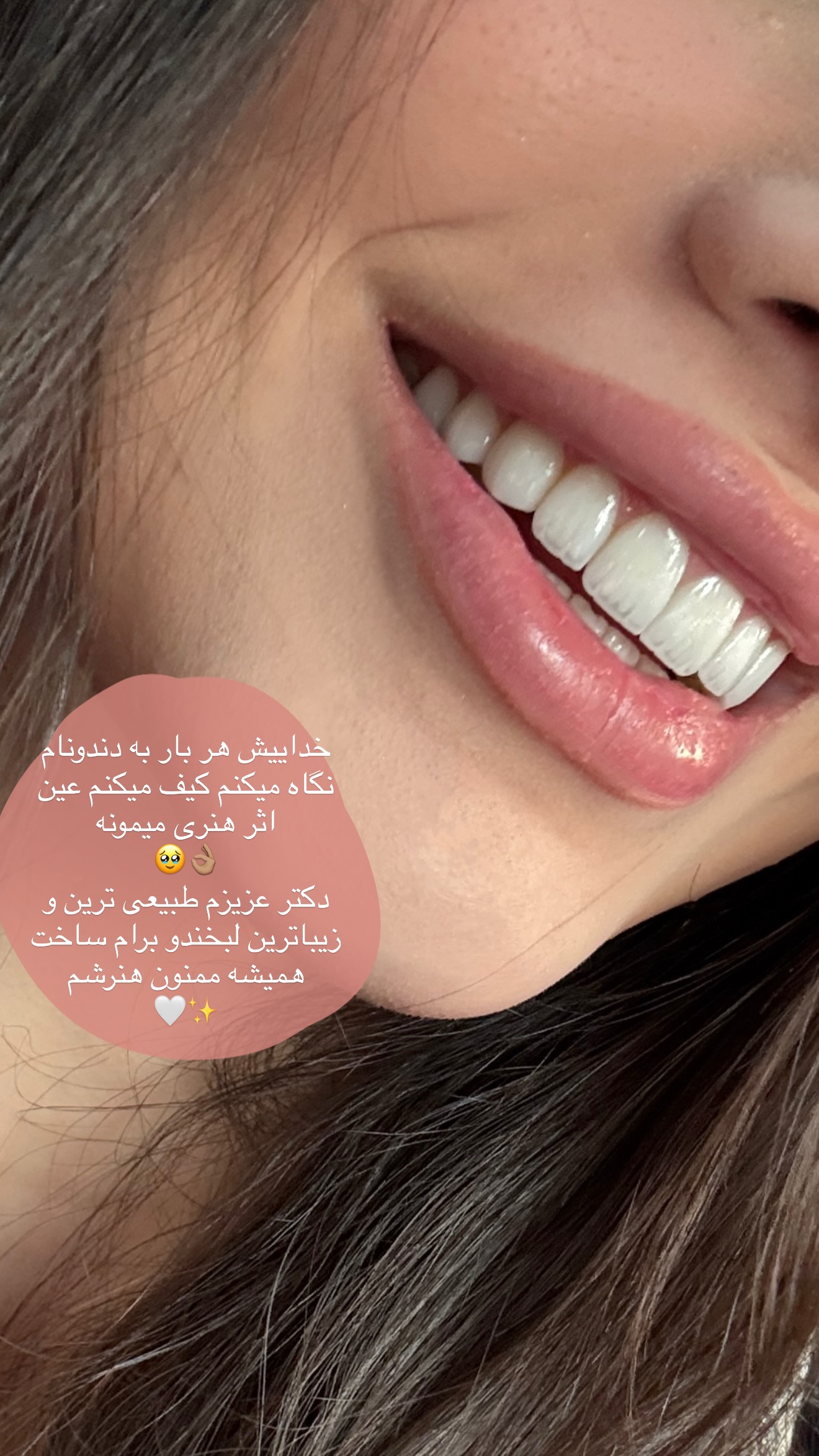  جدید ترین استوری اینستاگرام شکیبا لطفی