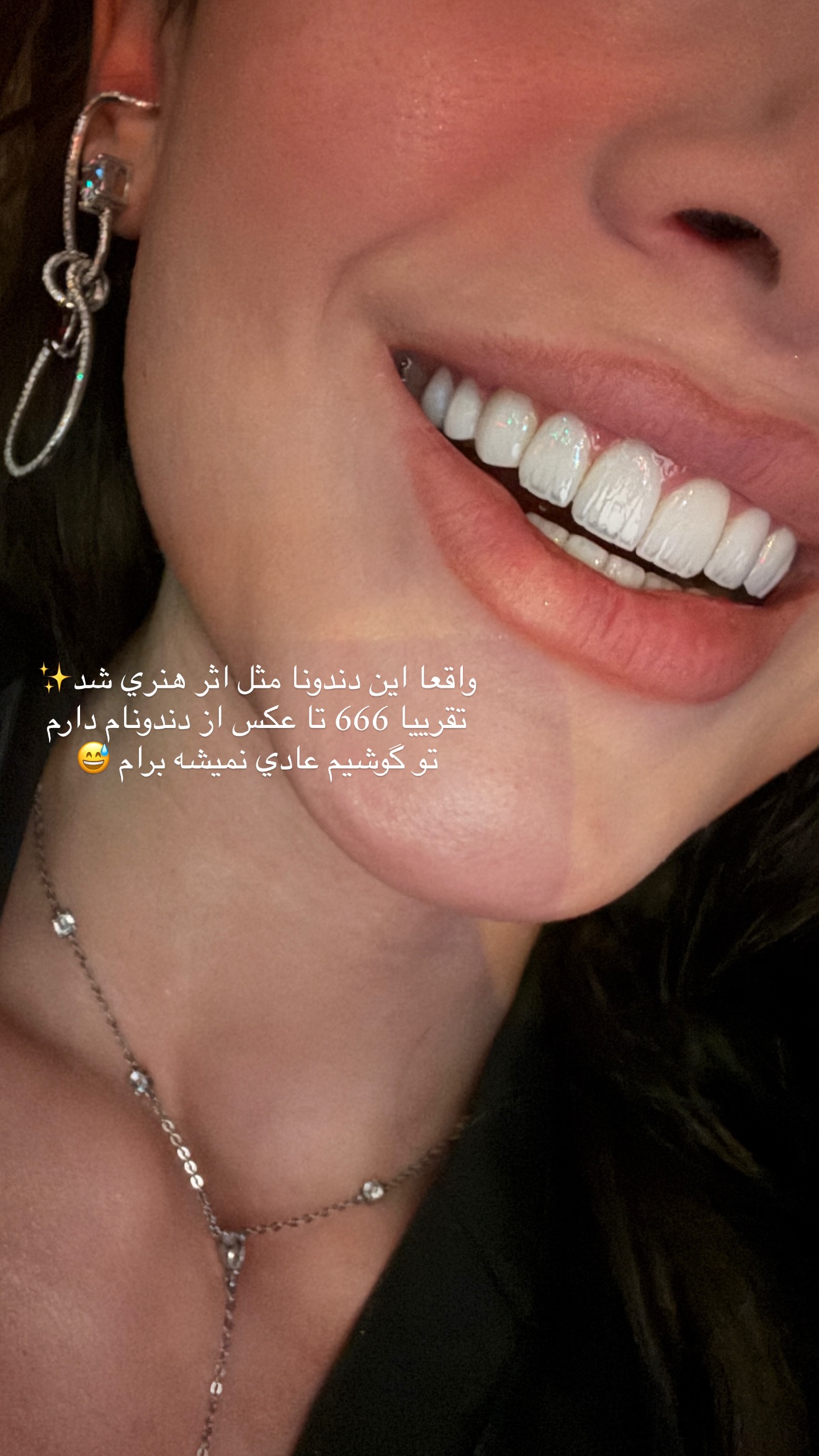  جدید ترین استوری اینستاگرام شکیبا لطفی