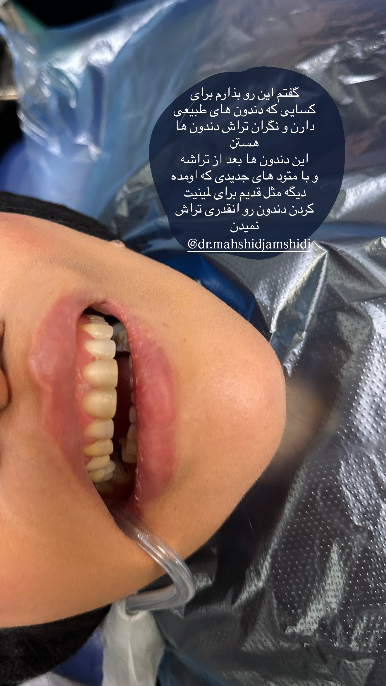 جدید ترین استوری اینستاگرام شکیبا لطفی