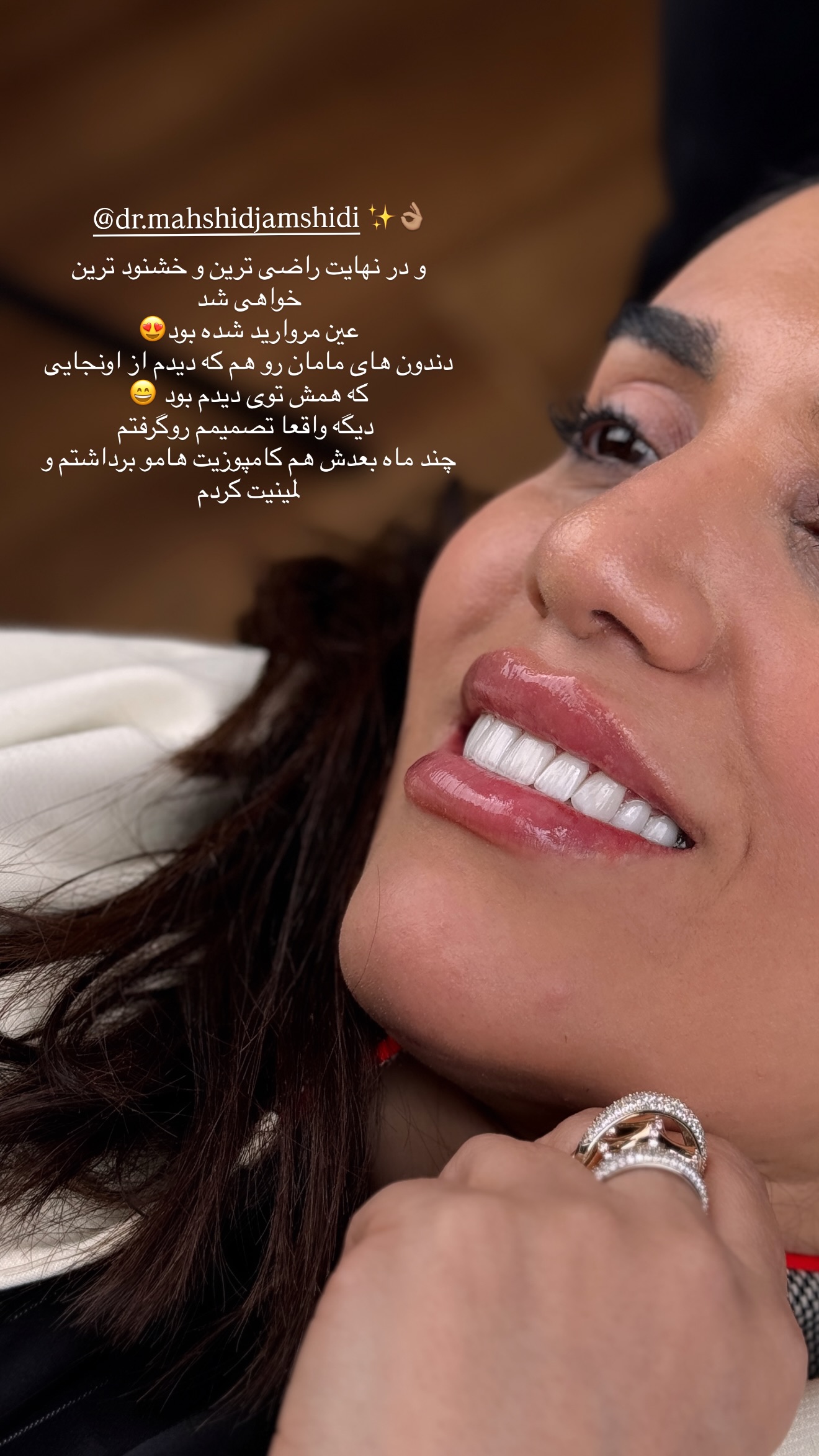  جدید ترین استوری اینستاگرام شکیبا لطفی