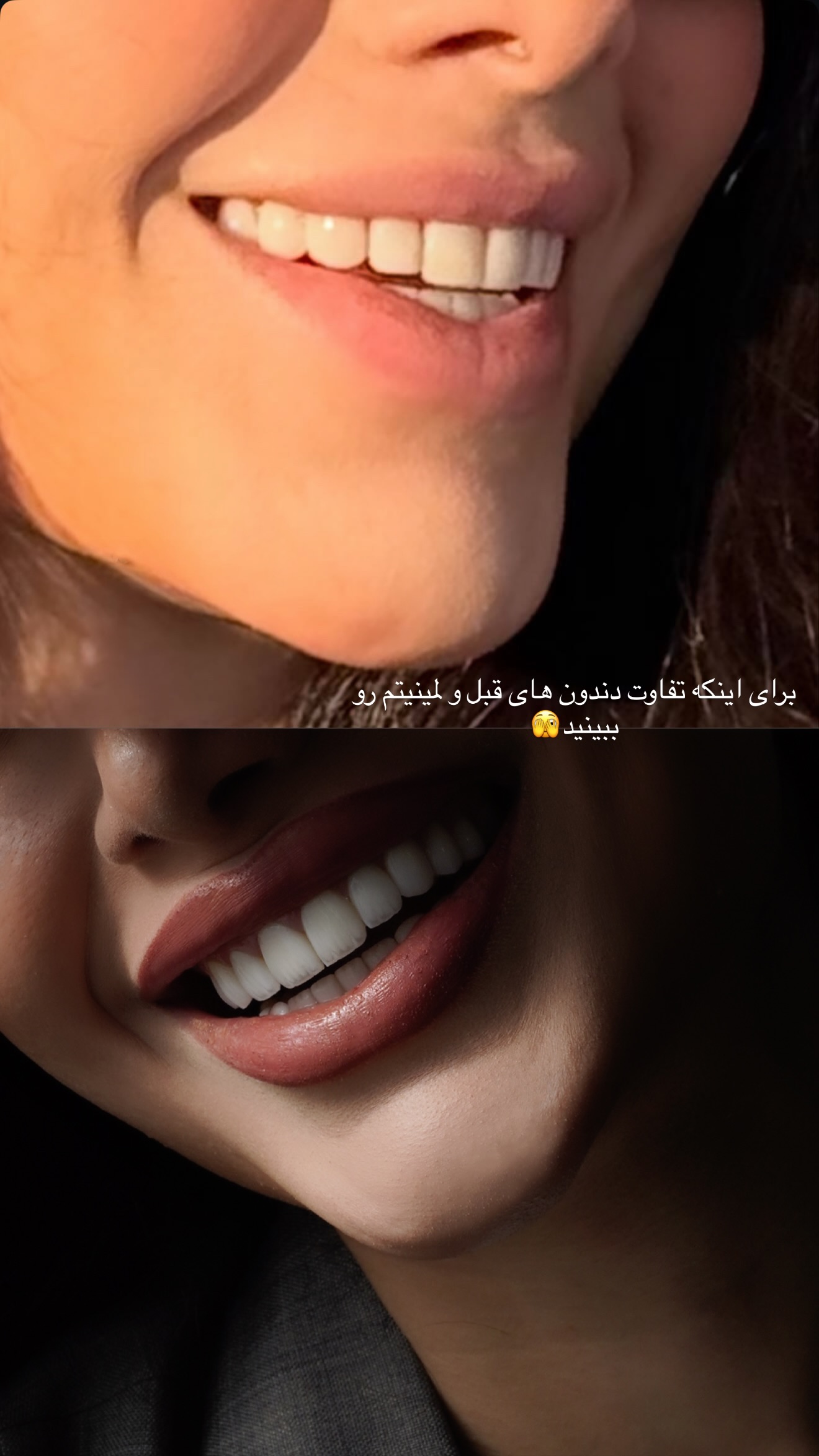  جدید ترین استوری اینستاگرام شکیبا لطفی