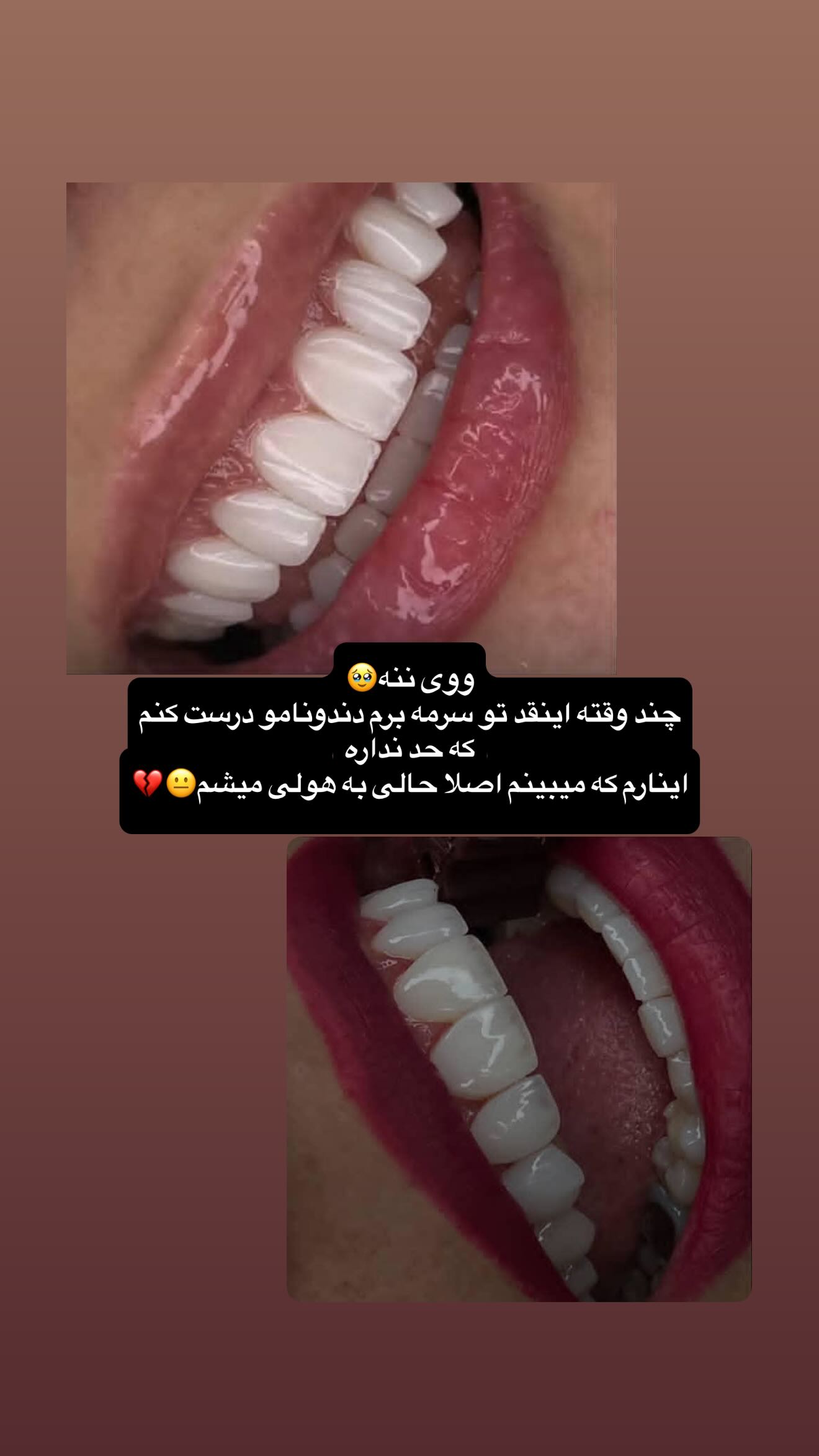  جدید ترین استوری اینستاگرام شقایق محمودی