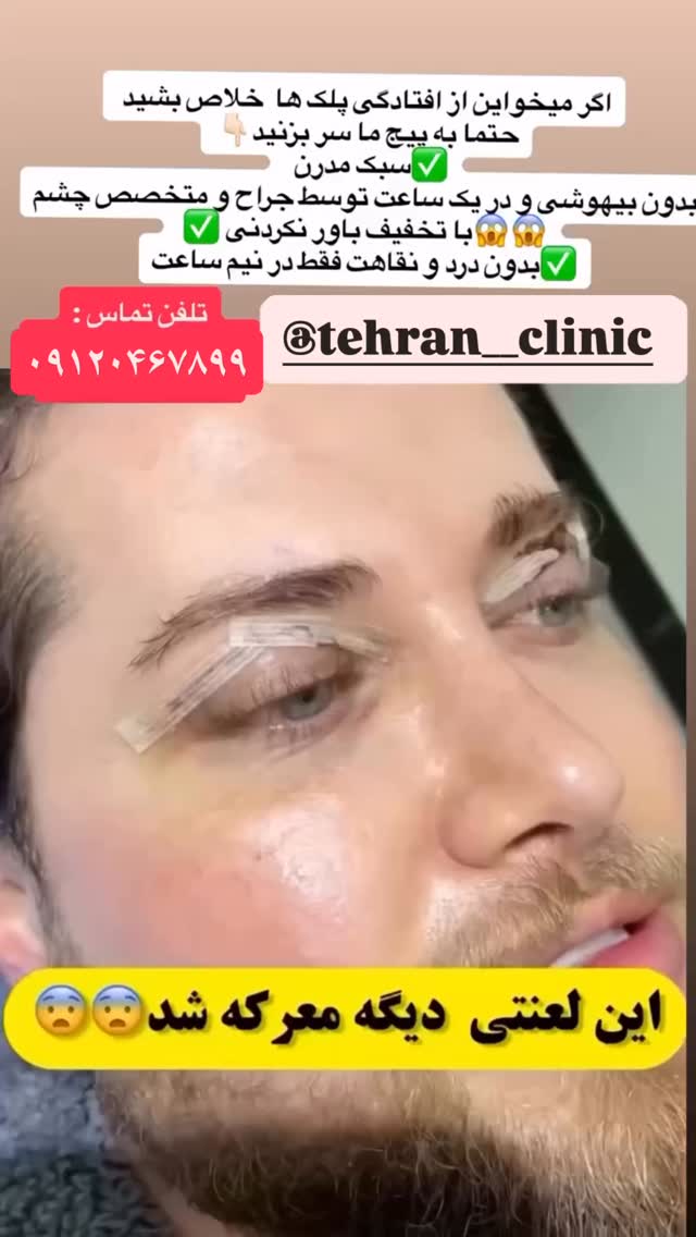  جدید ترین استوری اینستاگرام شکموها