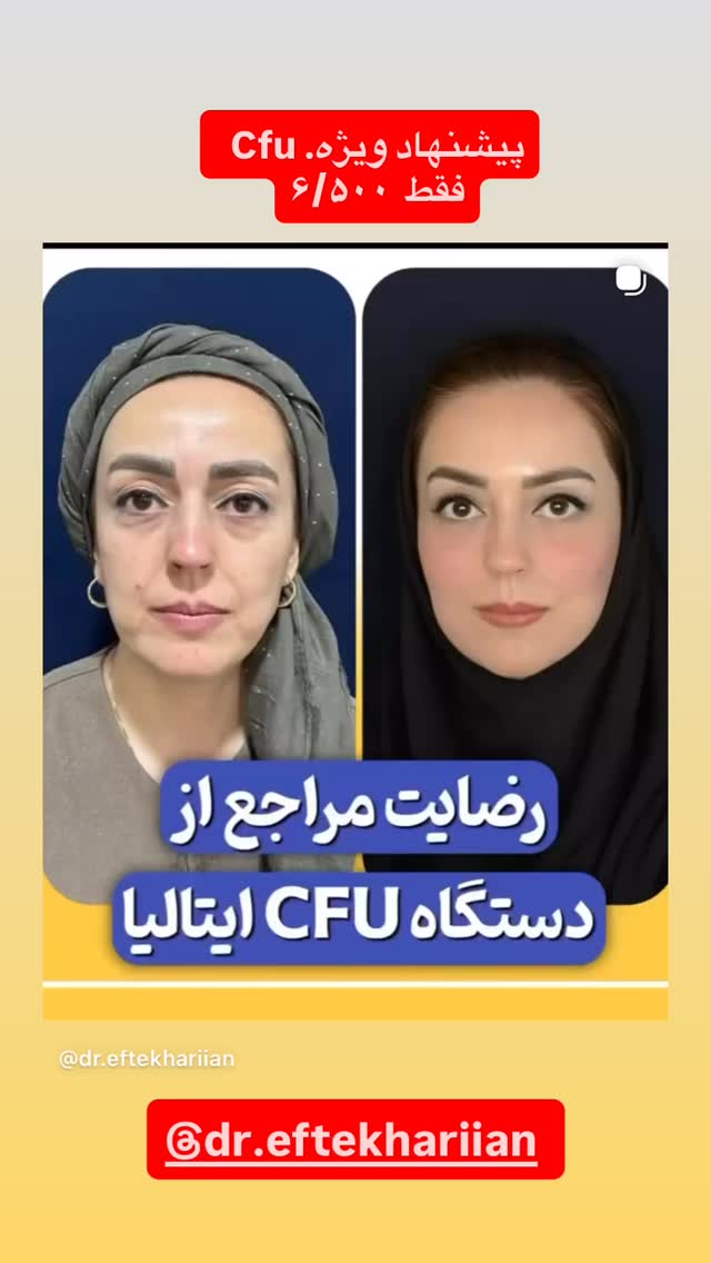  جدید ترین استوری اینستاگرام شکموها