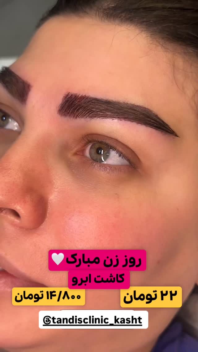 جدید ترین استوری اینستاگرام شکموها