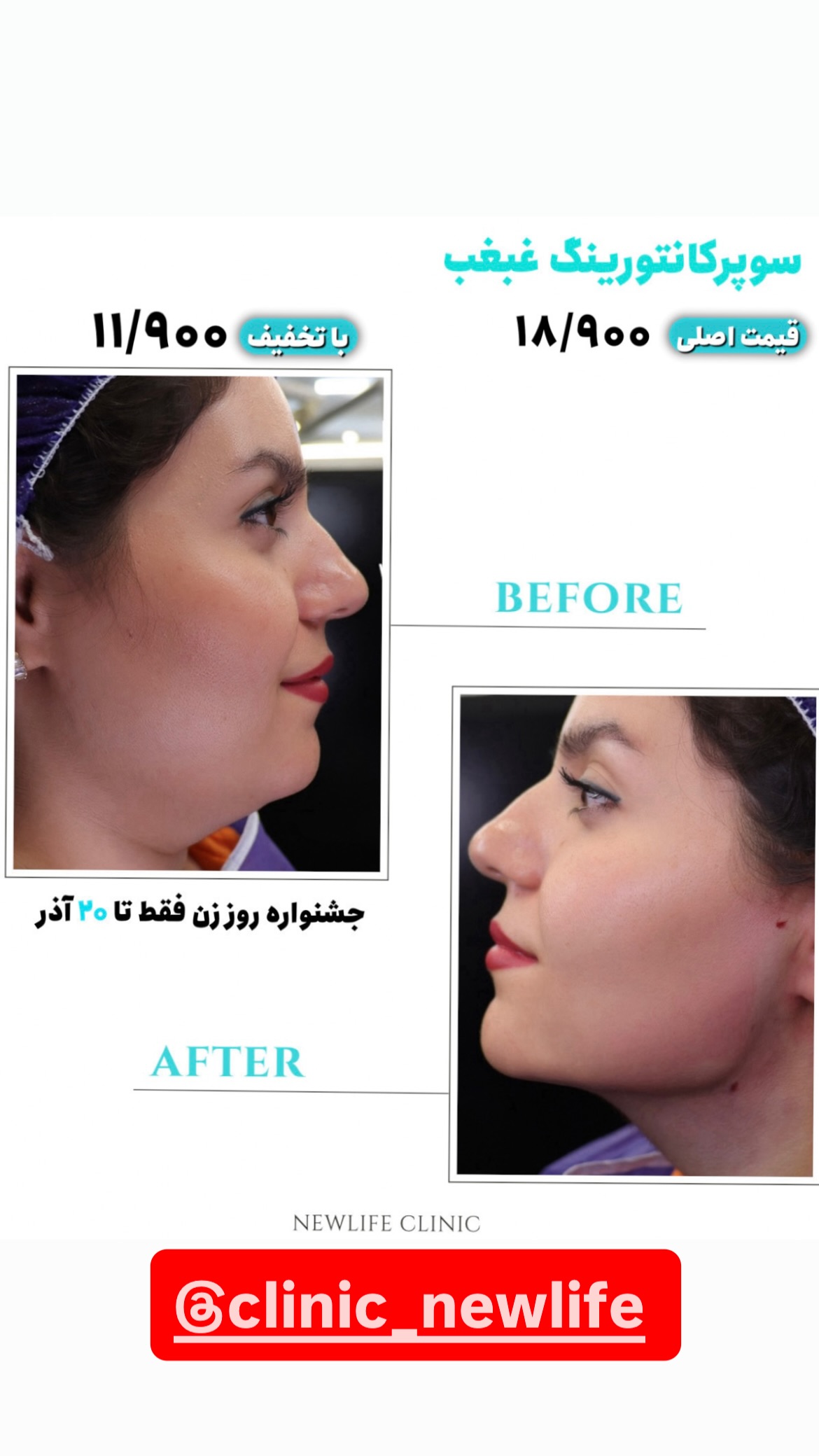  جدید ترین استوری اینستاگرام شکموها