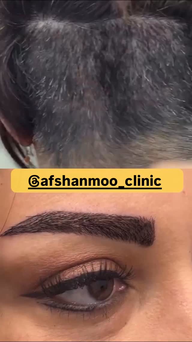  جدید ترین استوری اینستاگرام شکموها