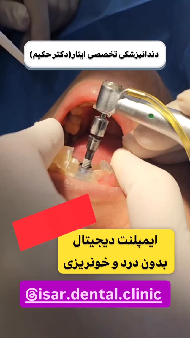  جدید ترین استوری اینستاگرام شکموها