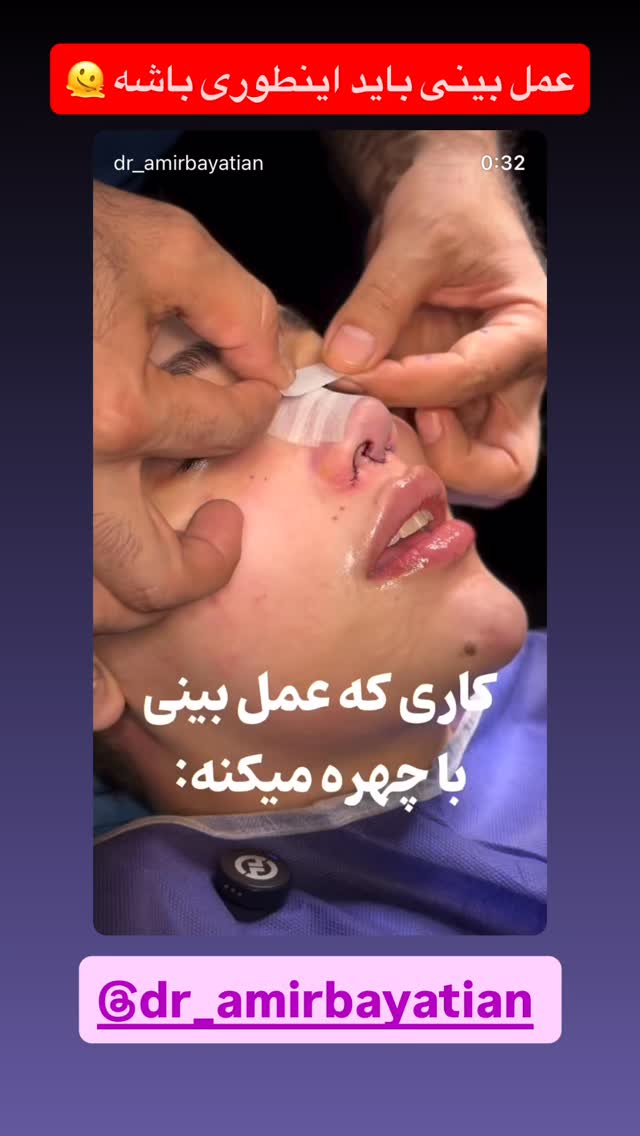  جدید ترین استوری اینستاگرام شکموها