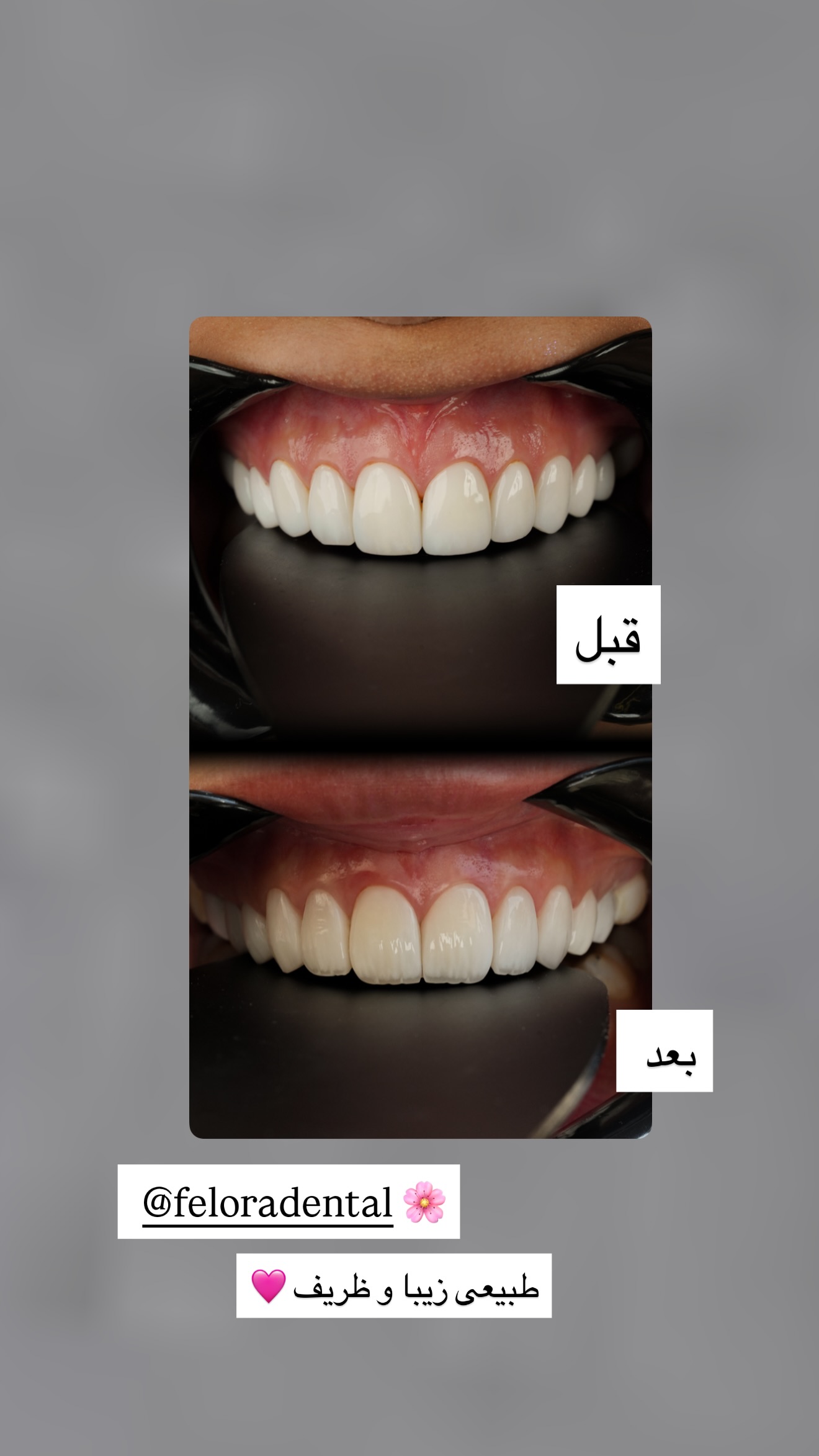  جدید ترین استوری اینستاگرام صدف