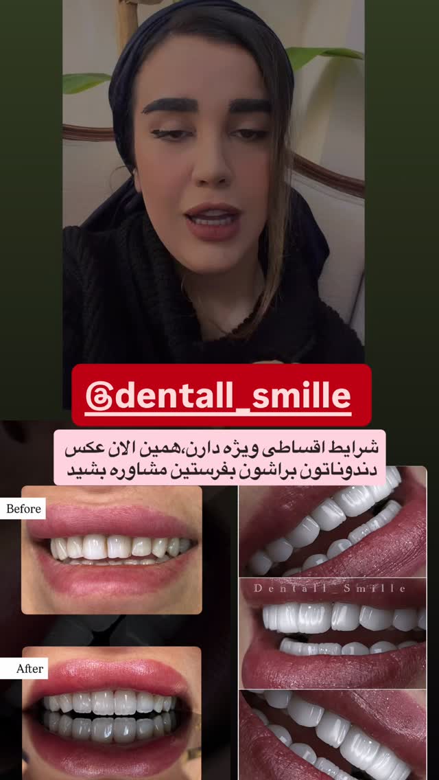  جدید ترین استوری اینستاگرام شعله حسینی