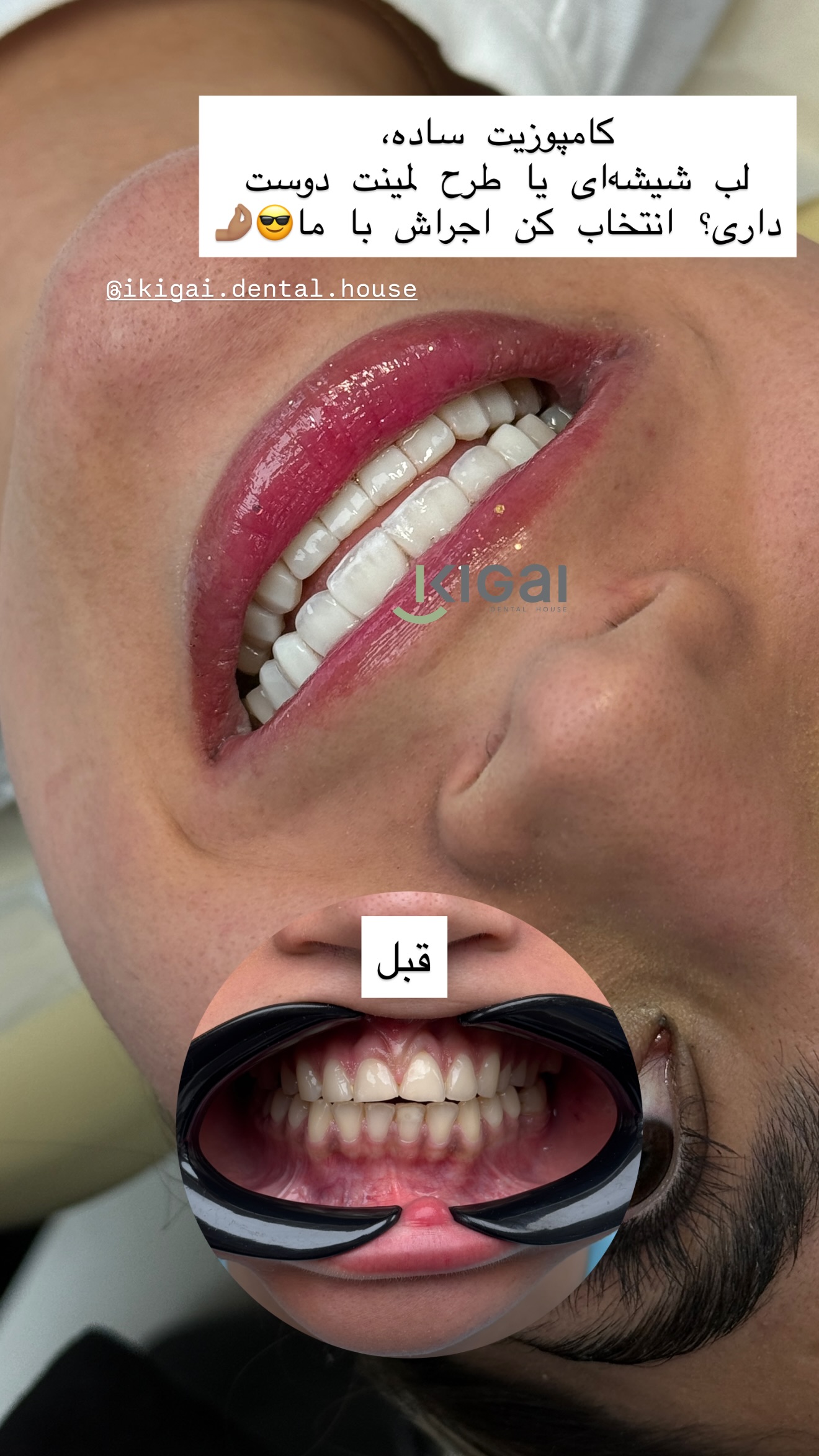  جدید ترین استوری اینستاگرام شیما
