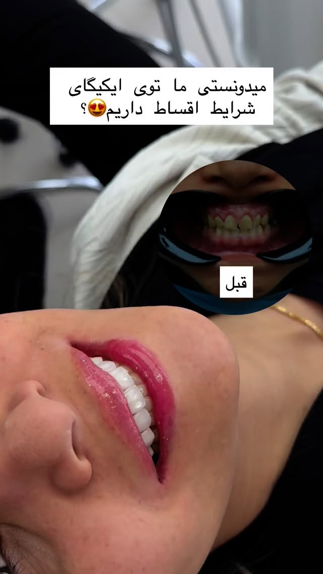  جدید ترین استوری اینستاگرام شیما