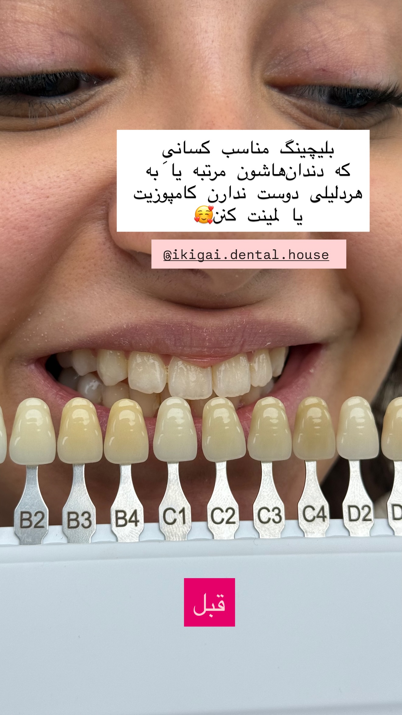  جدید ترین استوری اینستاگرام شیما