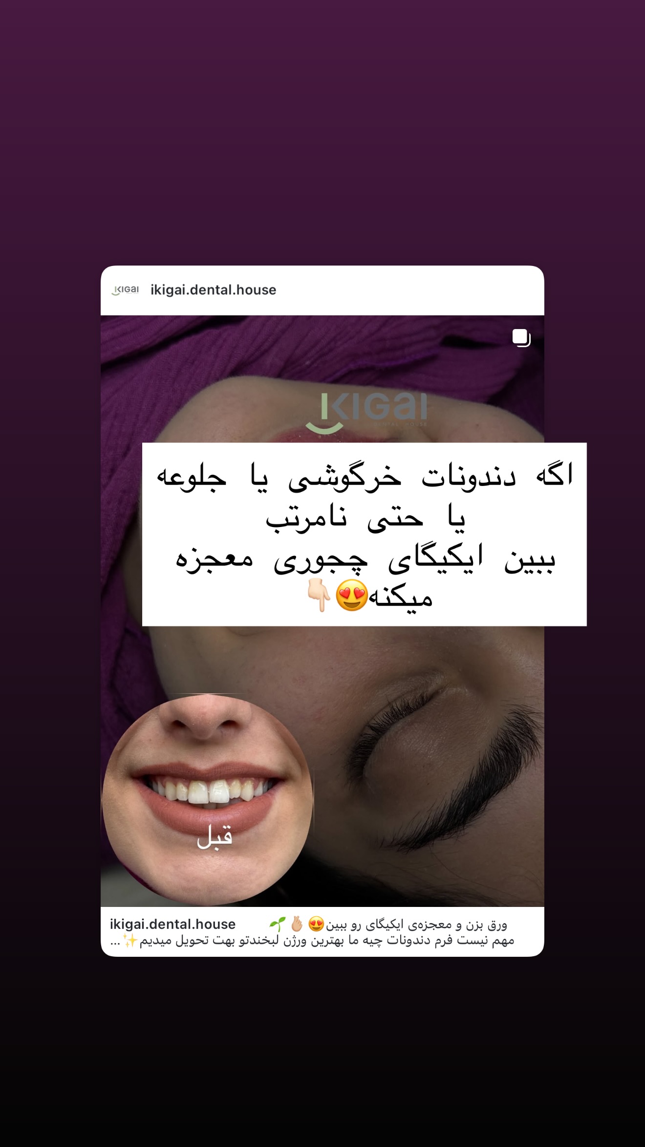  جدید ترین استوری اینستاگرام شیما