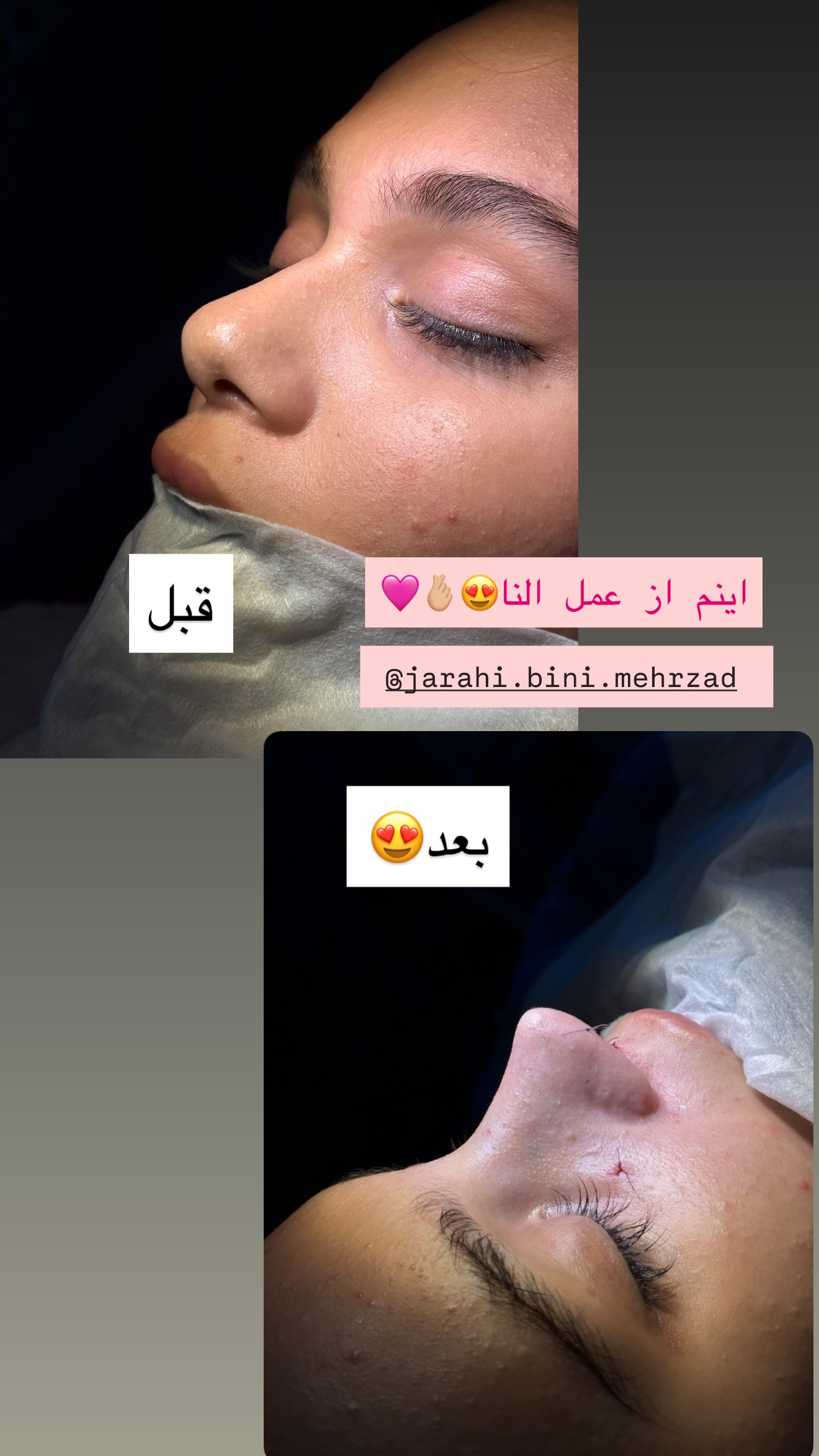  جدید ترین استوری اینستاگرام شیما