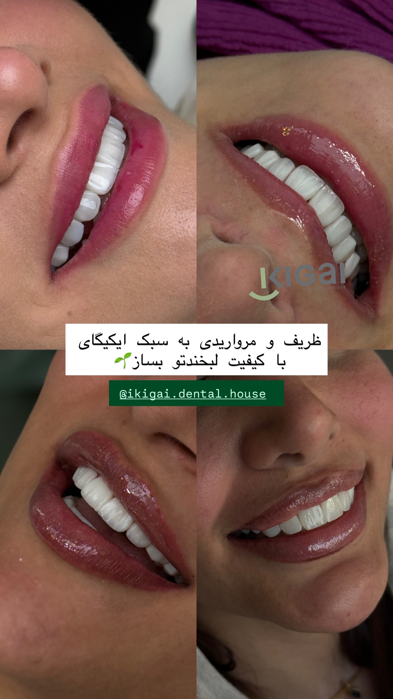  جدید ترین استوری اینستاگرام شیما