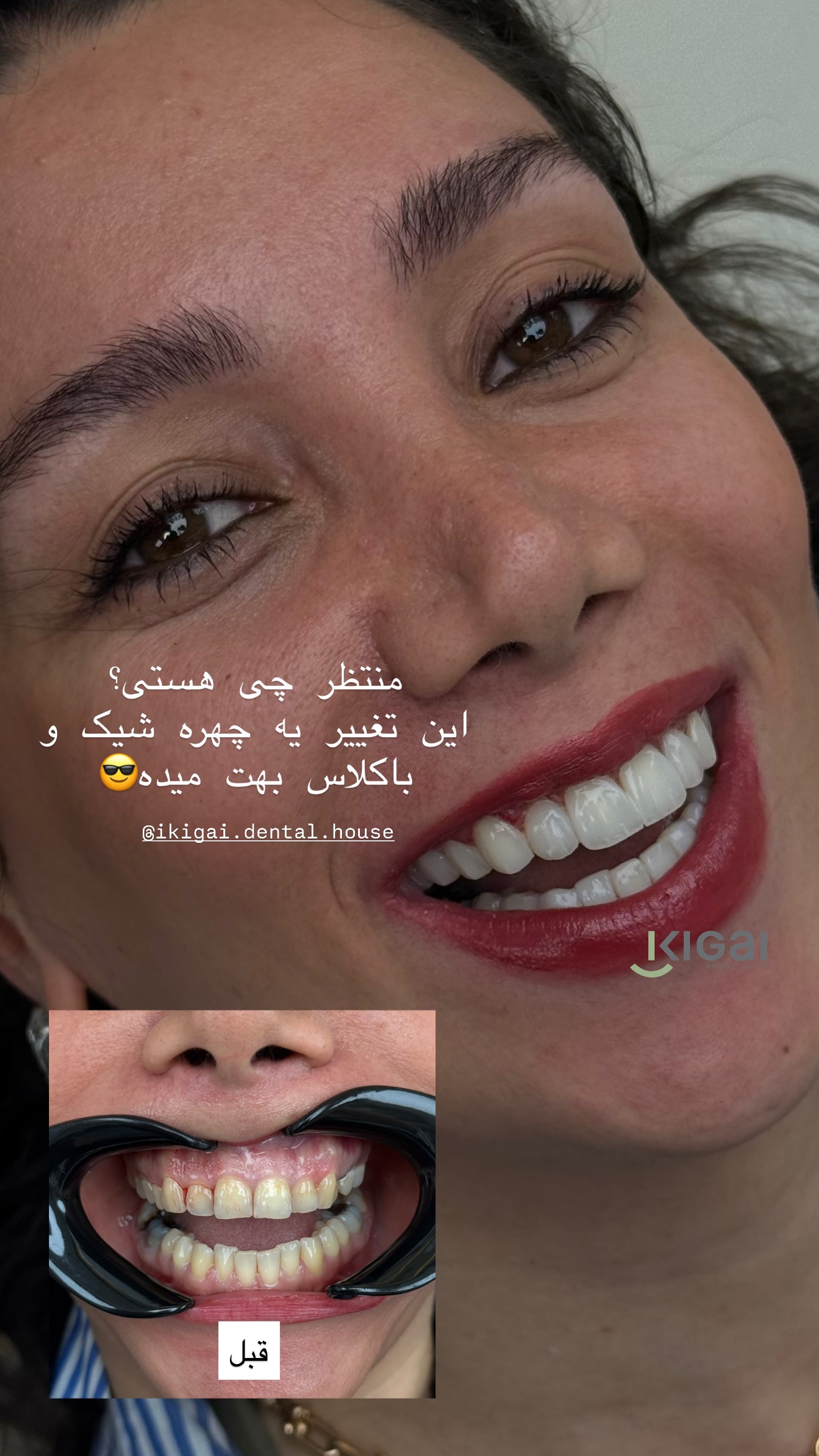  جدید ترین استوری اینستاگرام شیما