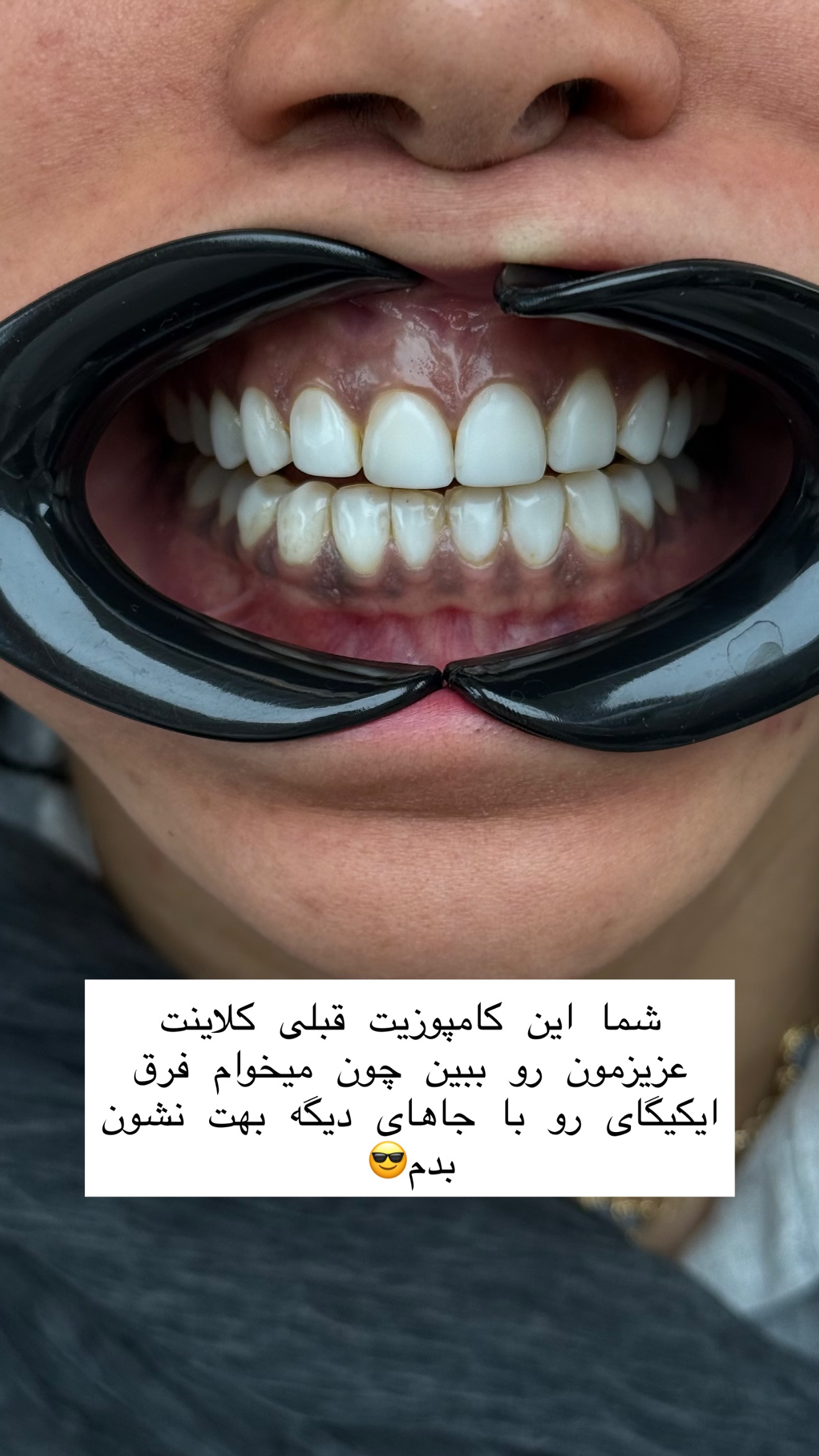  جدید ترین استوری اینستاگرام شیما