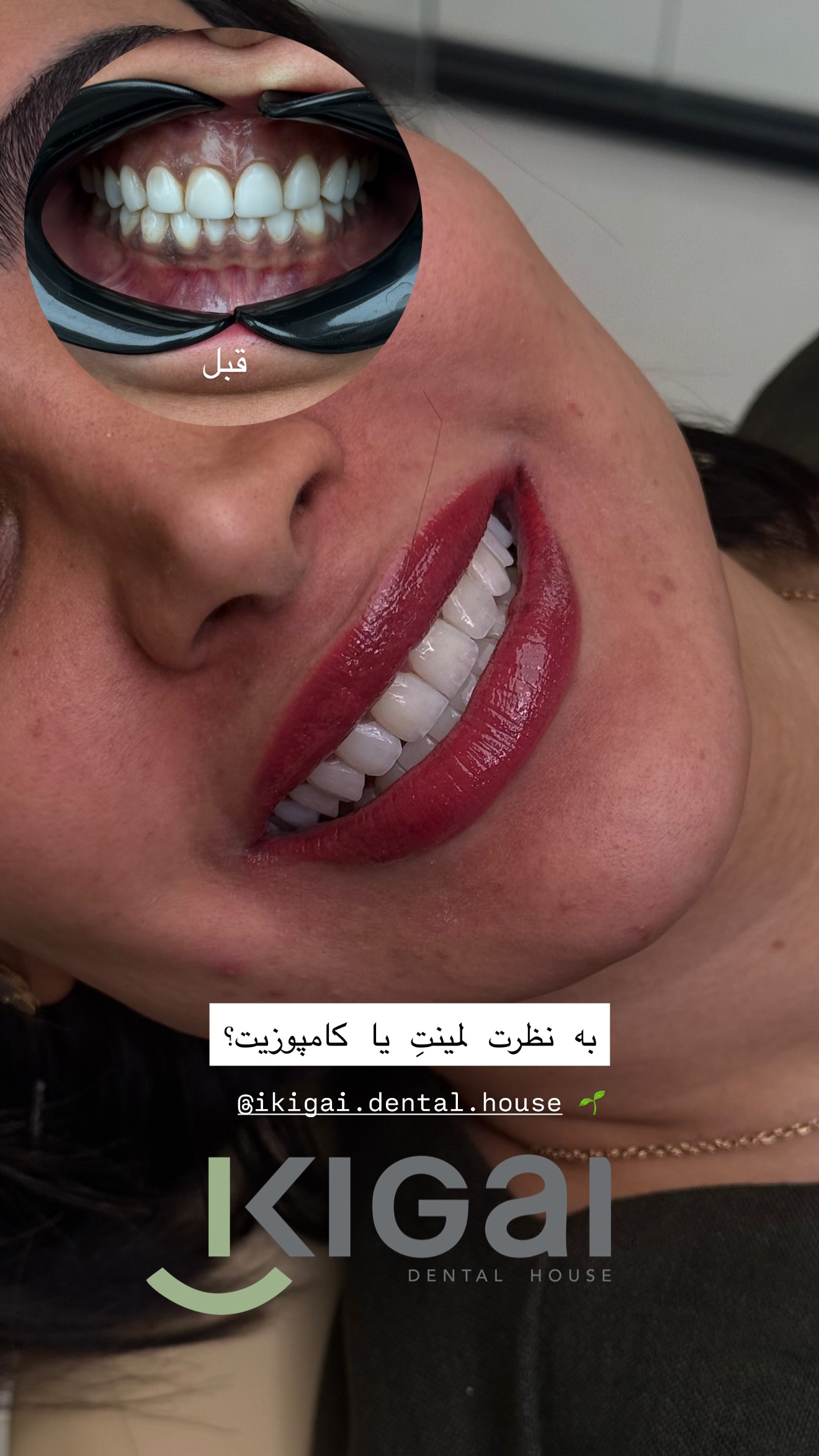  جدید ترین استوری اینستاگرام شیما