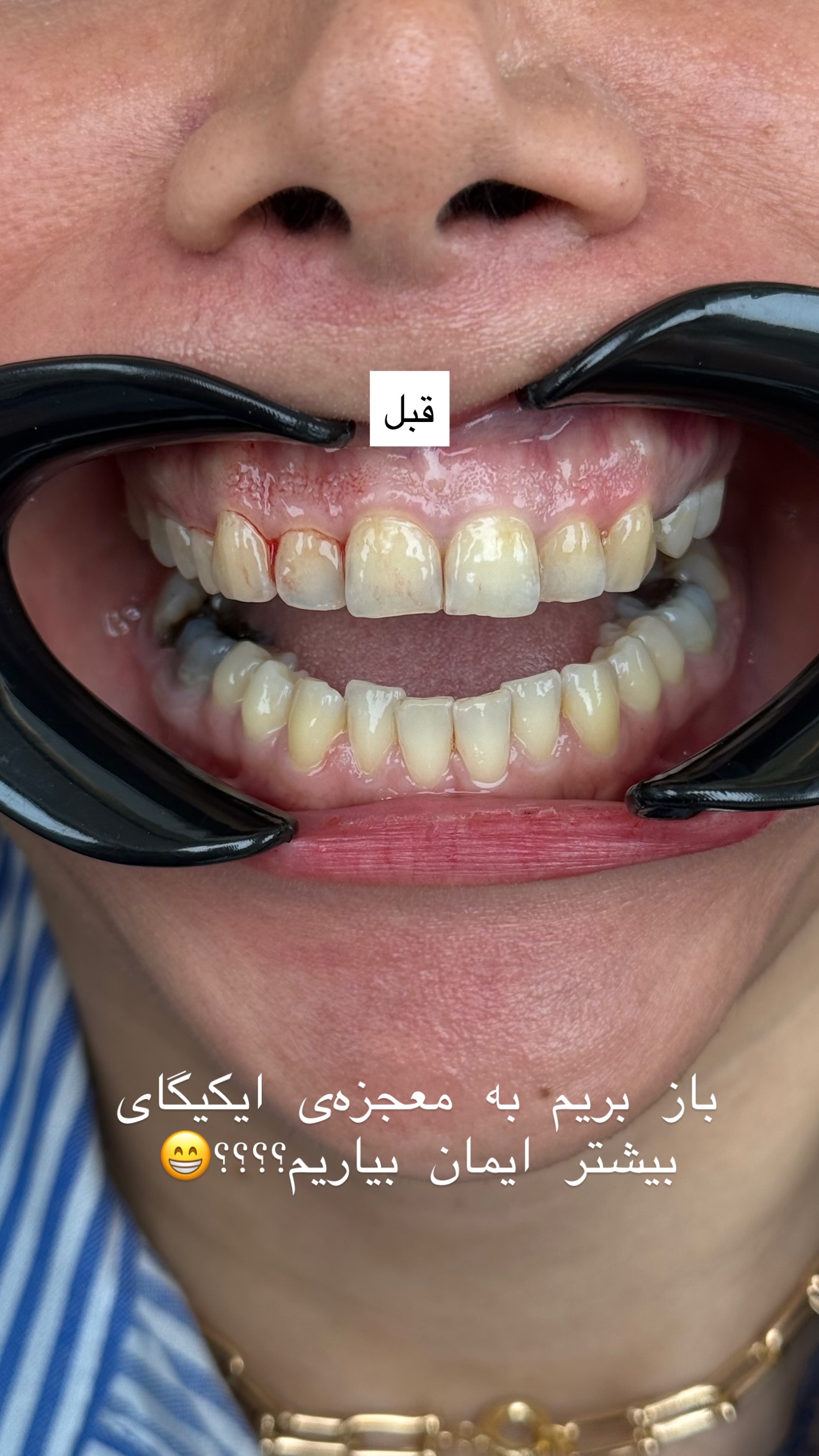  جدید ترین استوری اینستاگرام شیما