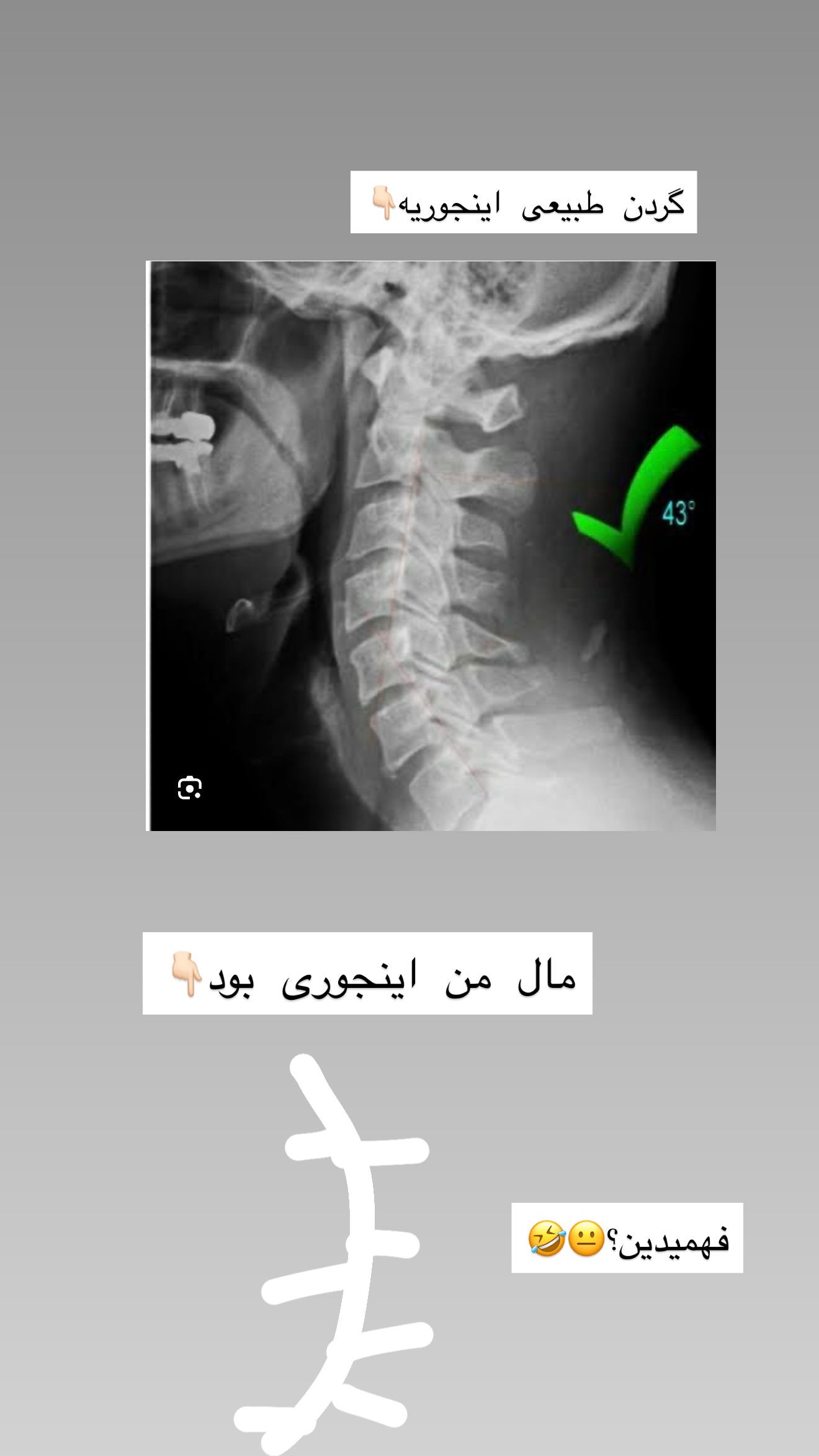  جدید ترین استوری اینستاگرام شیما