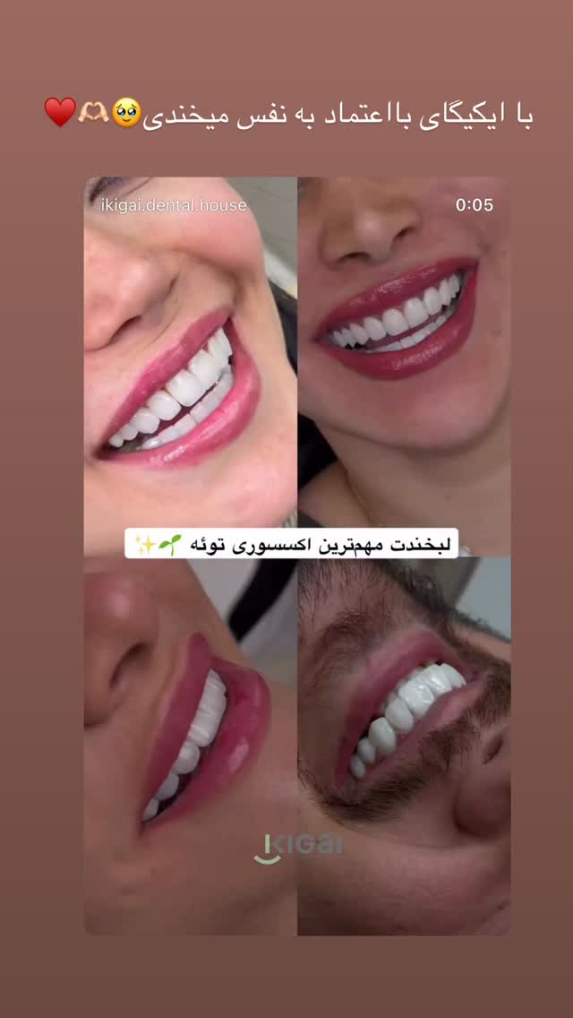  جدید ترین استوری اینستاگرام شیما