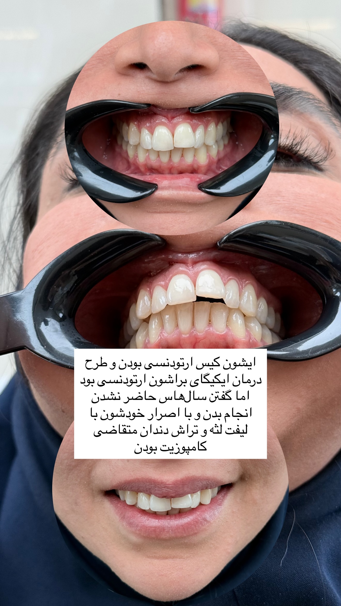  جدید ترین استوری اینستاگرام شیما