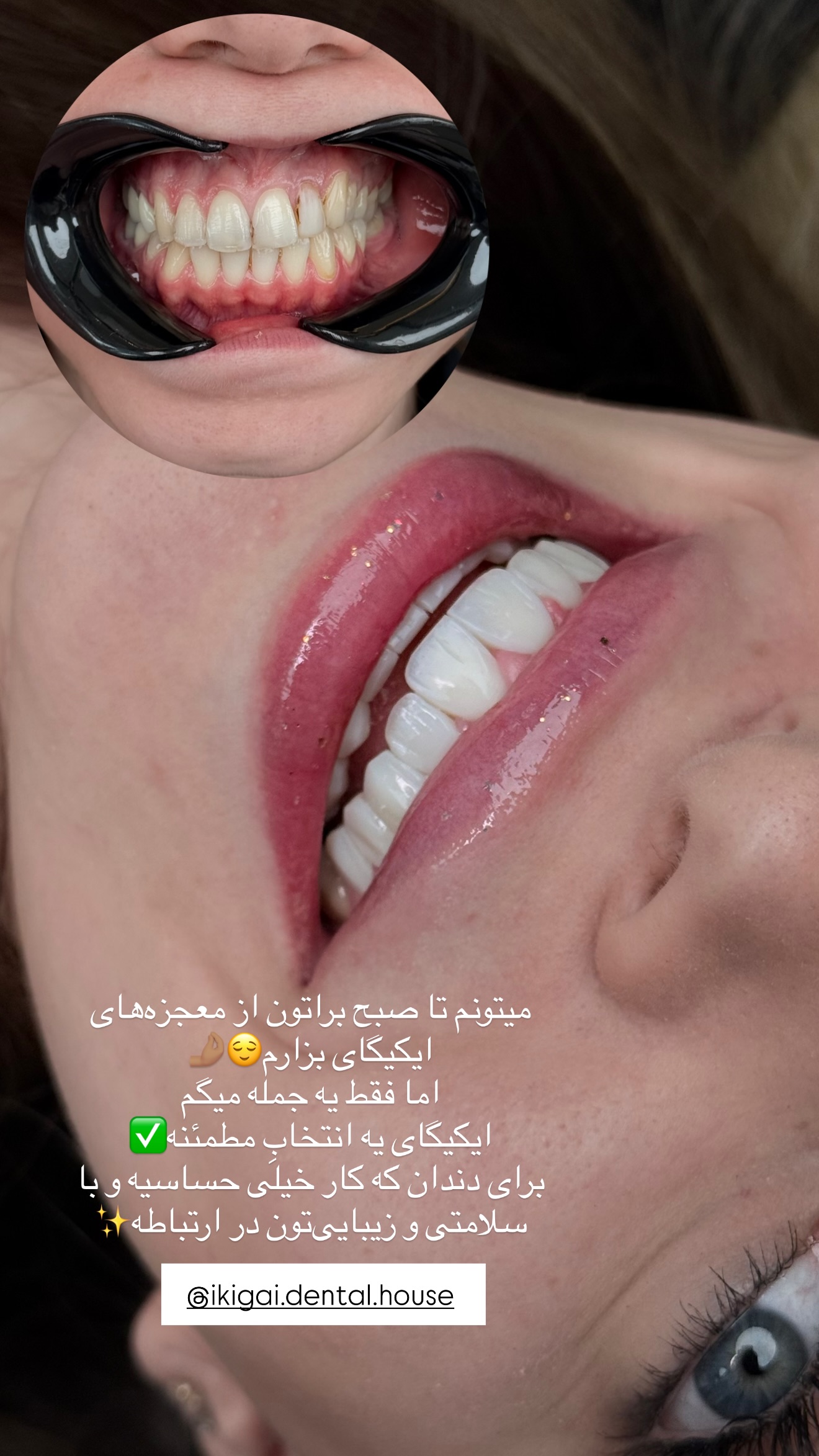  جدید ترین استوری اینستاگرام شیما