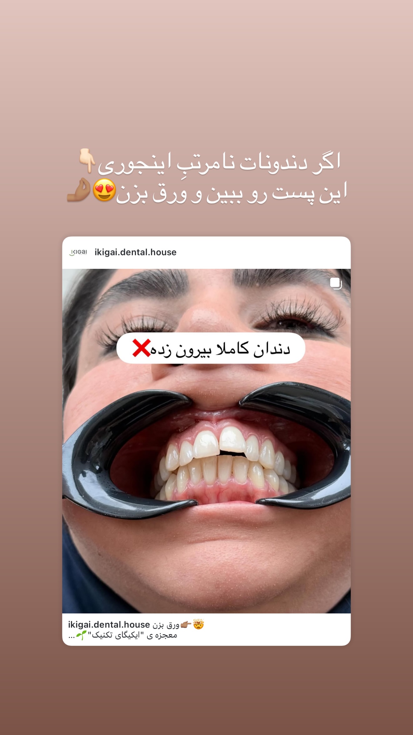  جدید ترین استوری اینستاگرام شیما