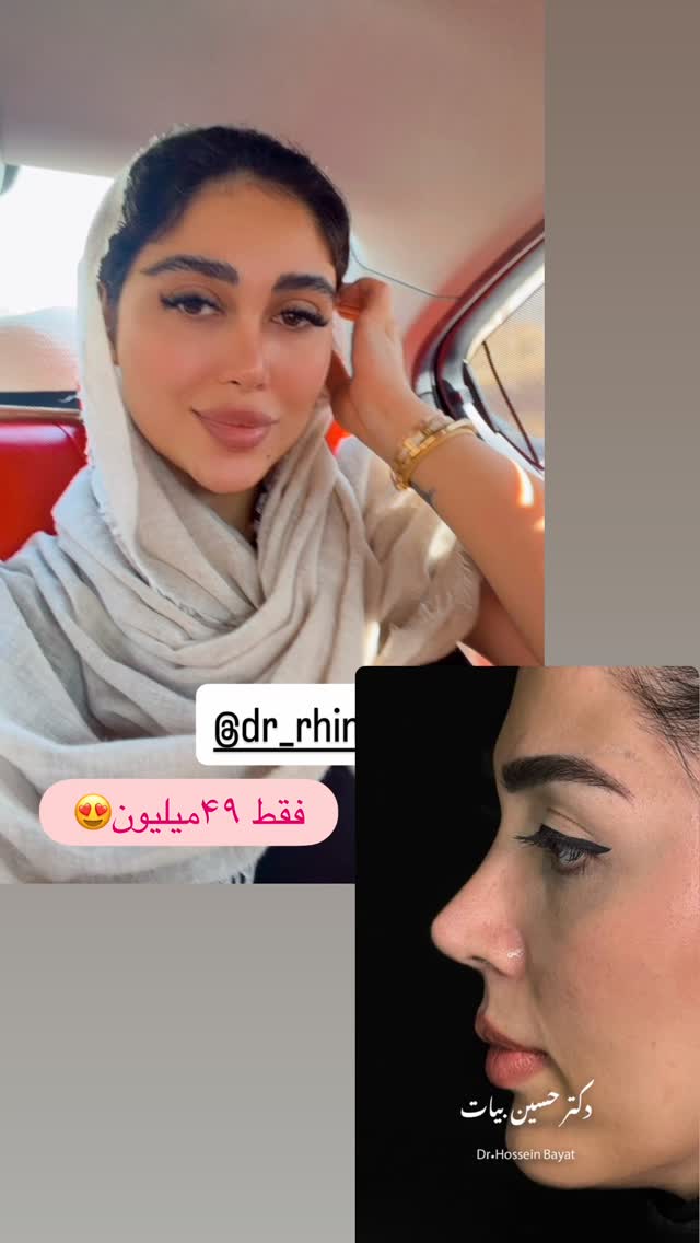  جدید ترین استوری اینستاگرام شیما