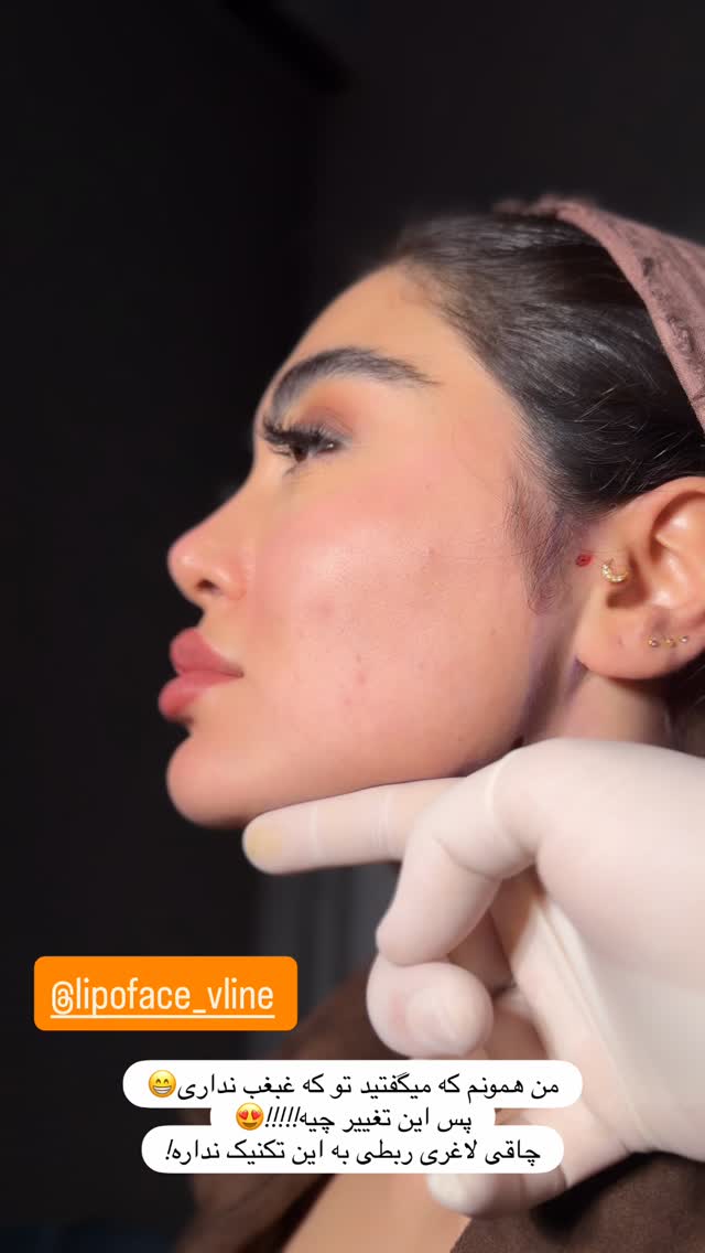  جدید ترین استوری اینستاگرام شیما