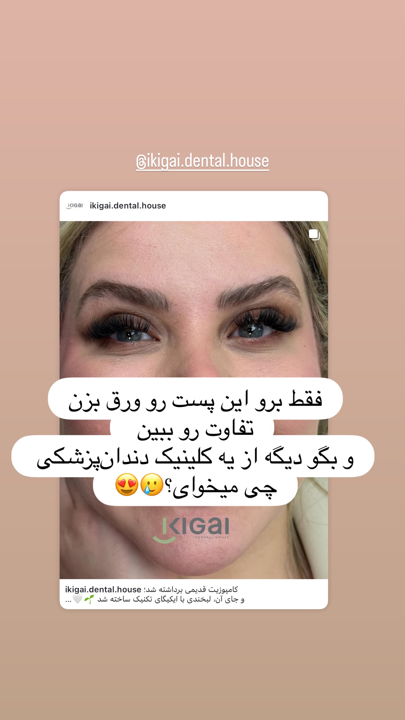  جدید ترین استوری اینستاگرام شیما