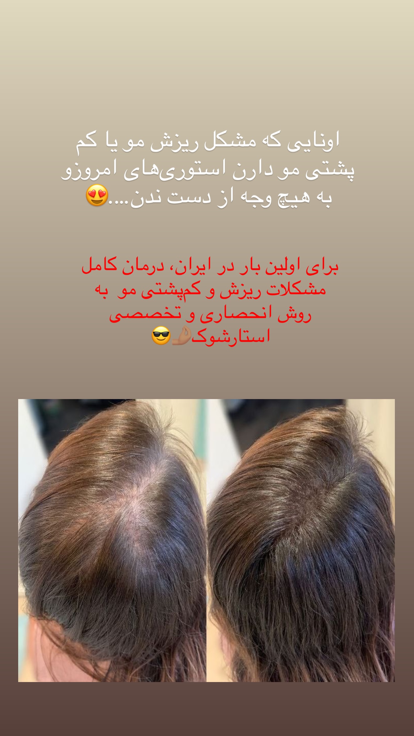  جدید ترین استوری اینستاگرام شیما