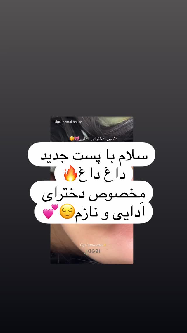  جدید ترین استوری اینستاگرام شیما