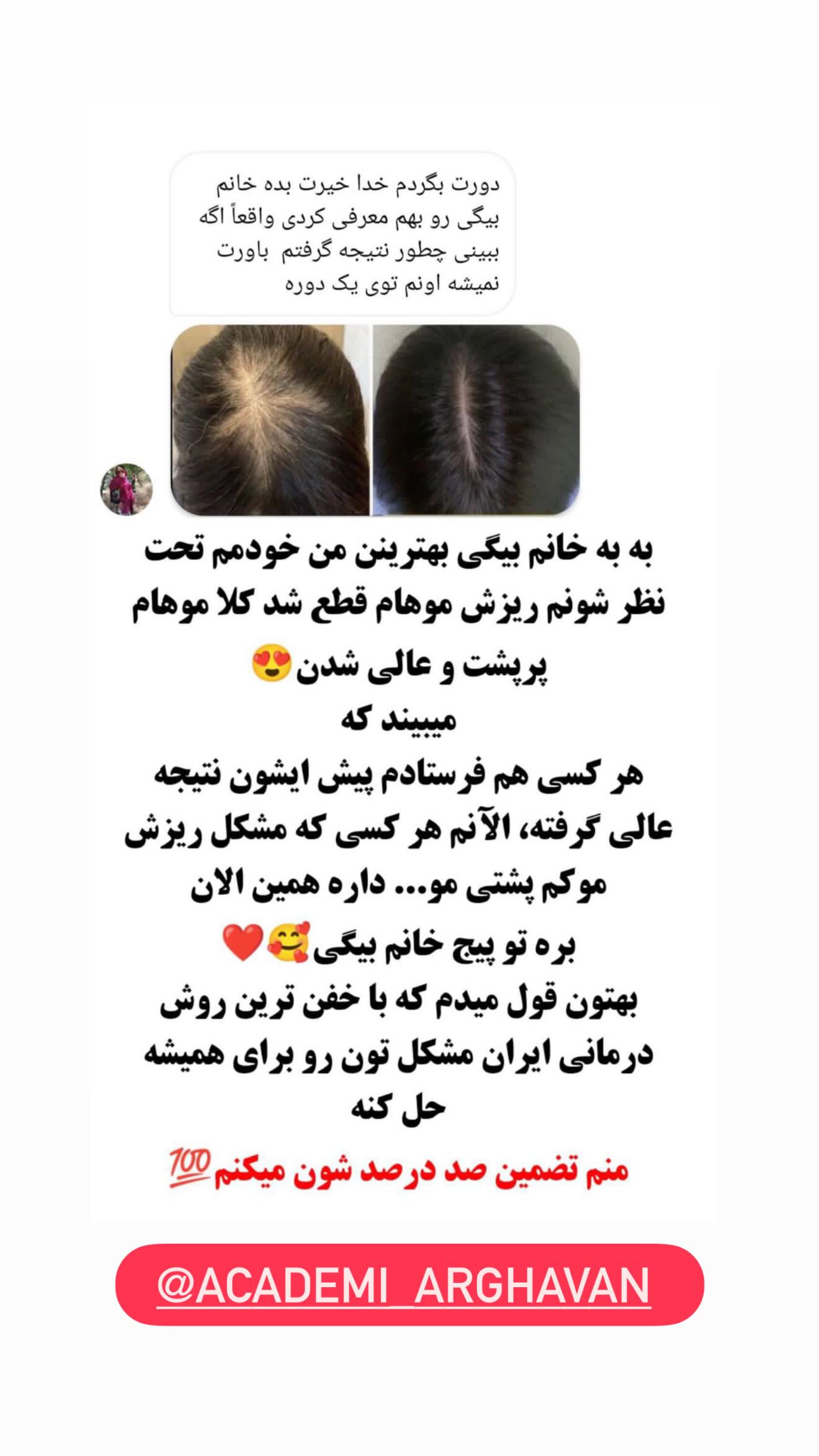  جدید ترین استوری اینستاگرام شیما زارعی