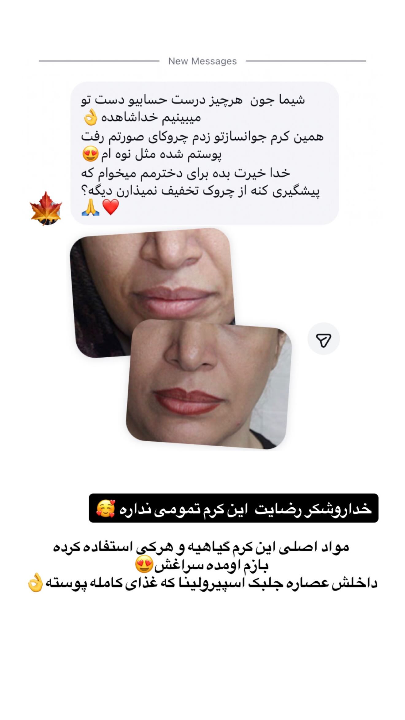  جدید ترین استوری اینستاگرام شیما زارعی