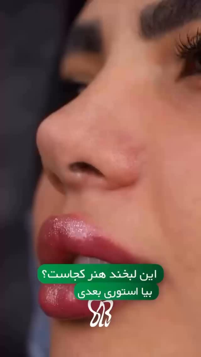  جدید ترین استوری اینستاگرام شیما زارعی