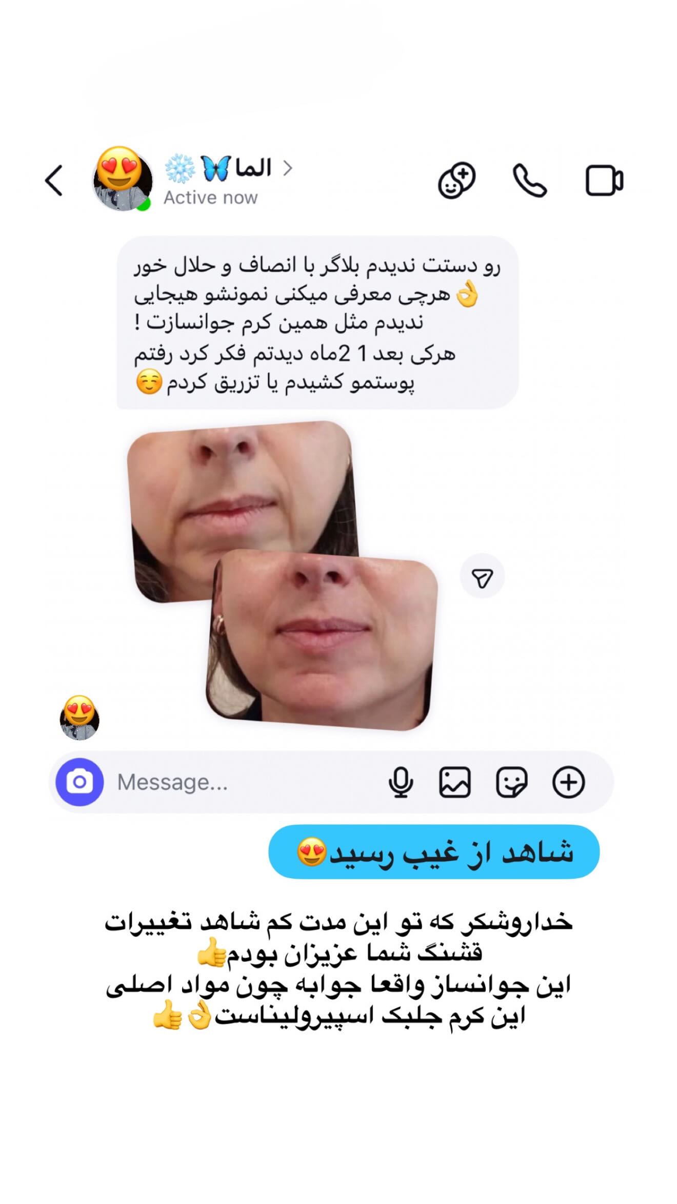  جدید ترین استوری اینستاگرام شیما زارعی