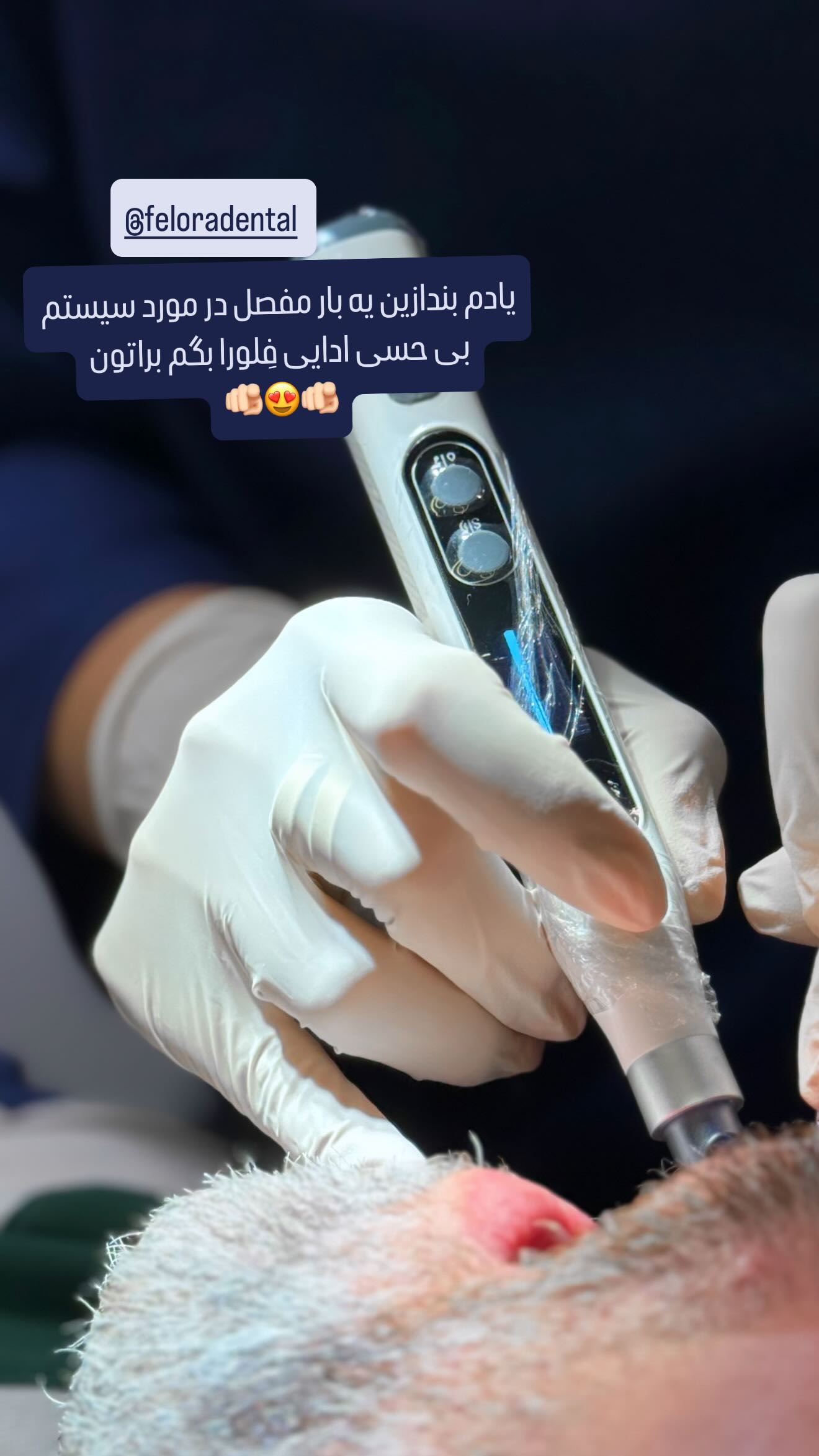  جدید ترین استوری اینستاگرام شیوا نصرتی