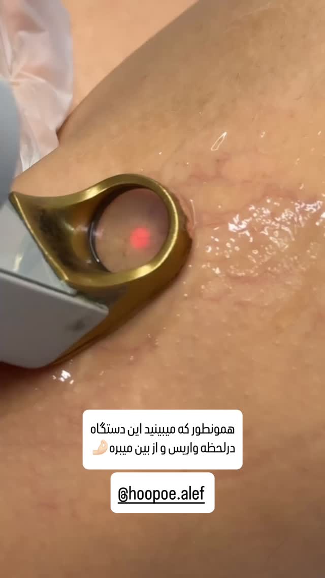  جدید ترین استوری اینستاگرام شیوا نصرتی