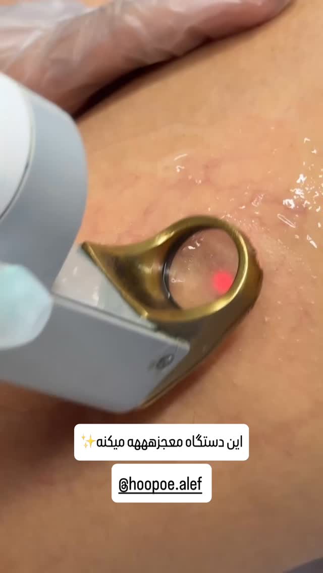  جدید ترین استوری اینستاگرام شیوا نصرتی