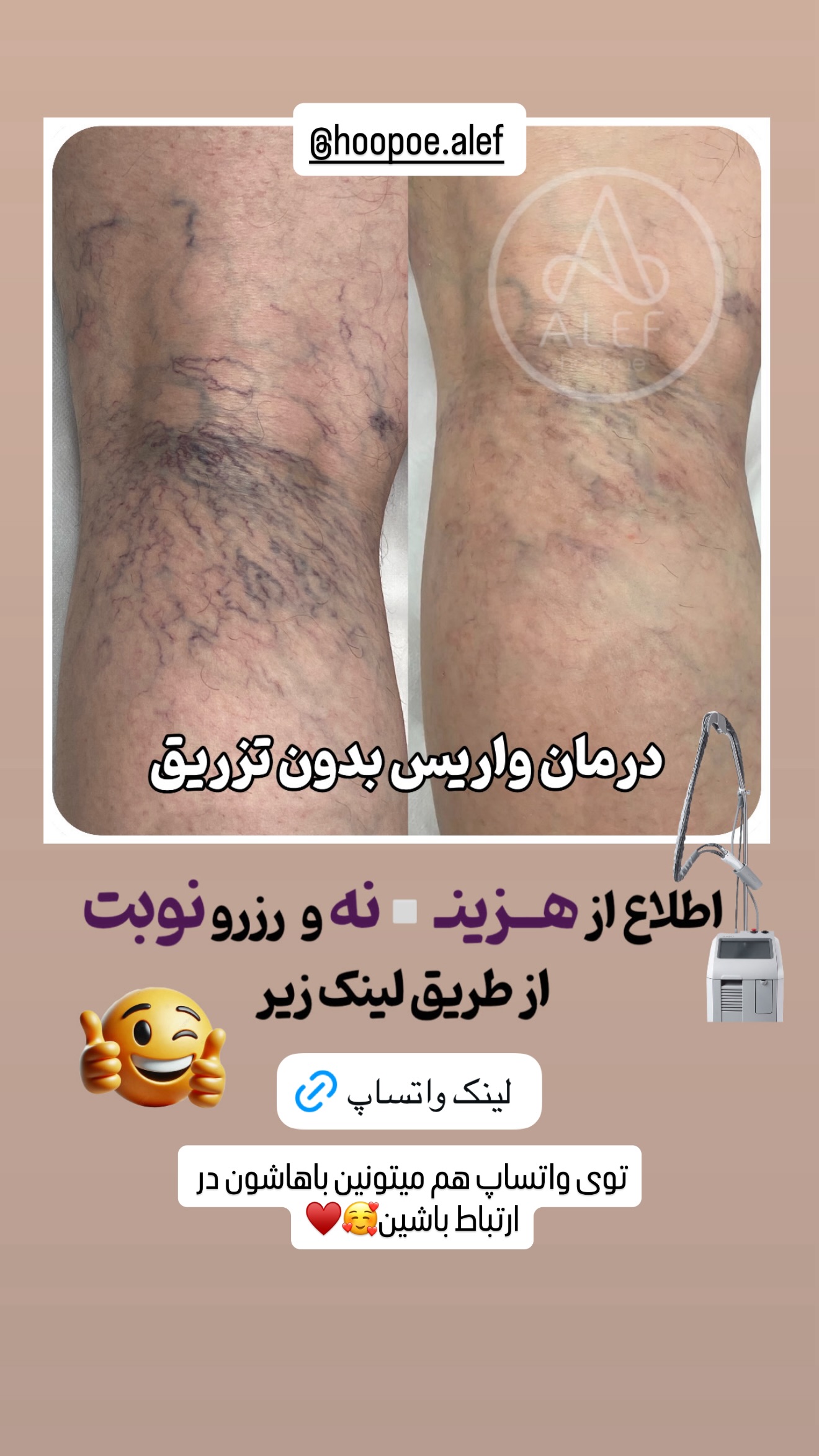  جدید ترین استوری اینستاگرام شیوا نصرتی