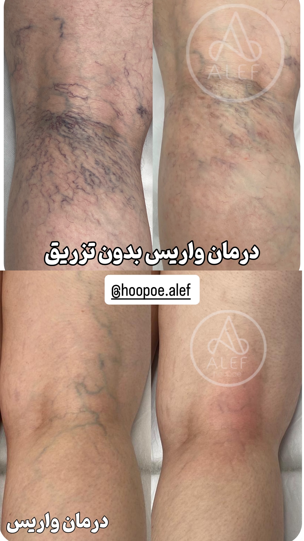  جدید ترین استوری اینستاگرام شیوا نصرتی